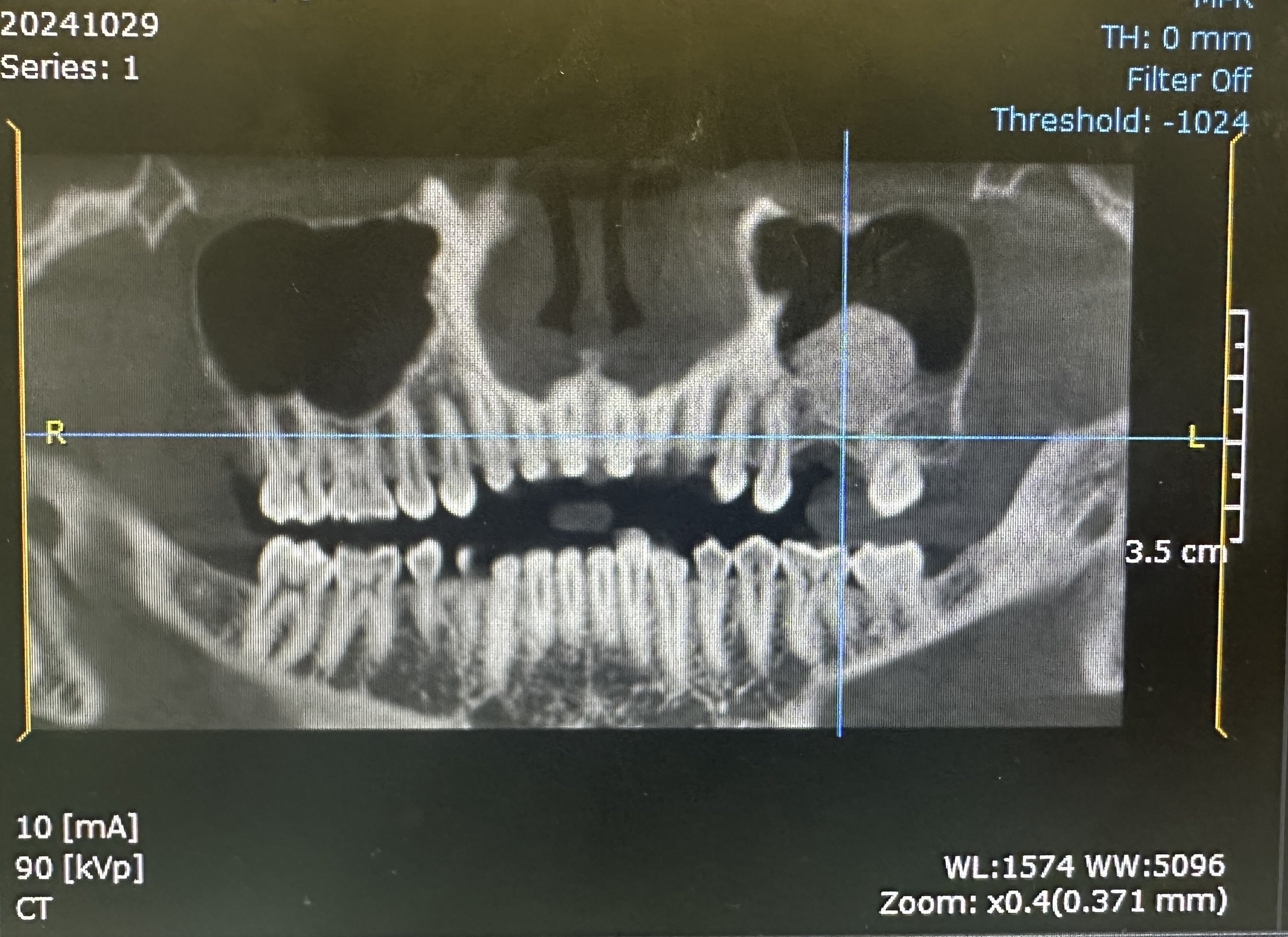 For professional reference only. All cases are anonymized and shared with patient confidentiality strictly maintained.
