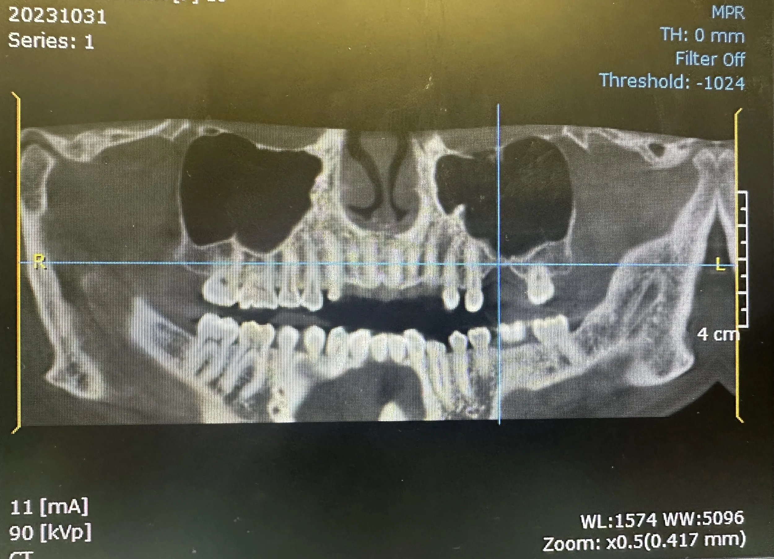 For professional reference only. All cases are anonymized and shared with patient confidentiality strictly maintained.