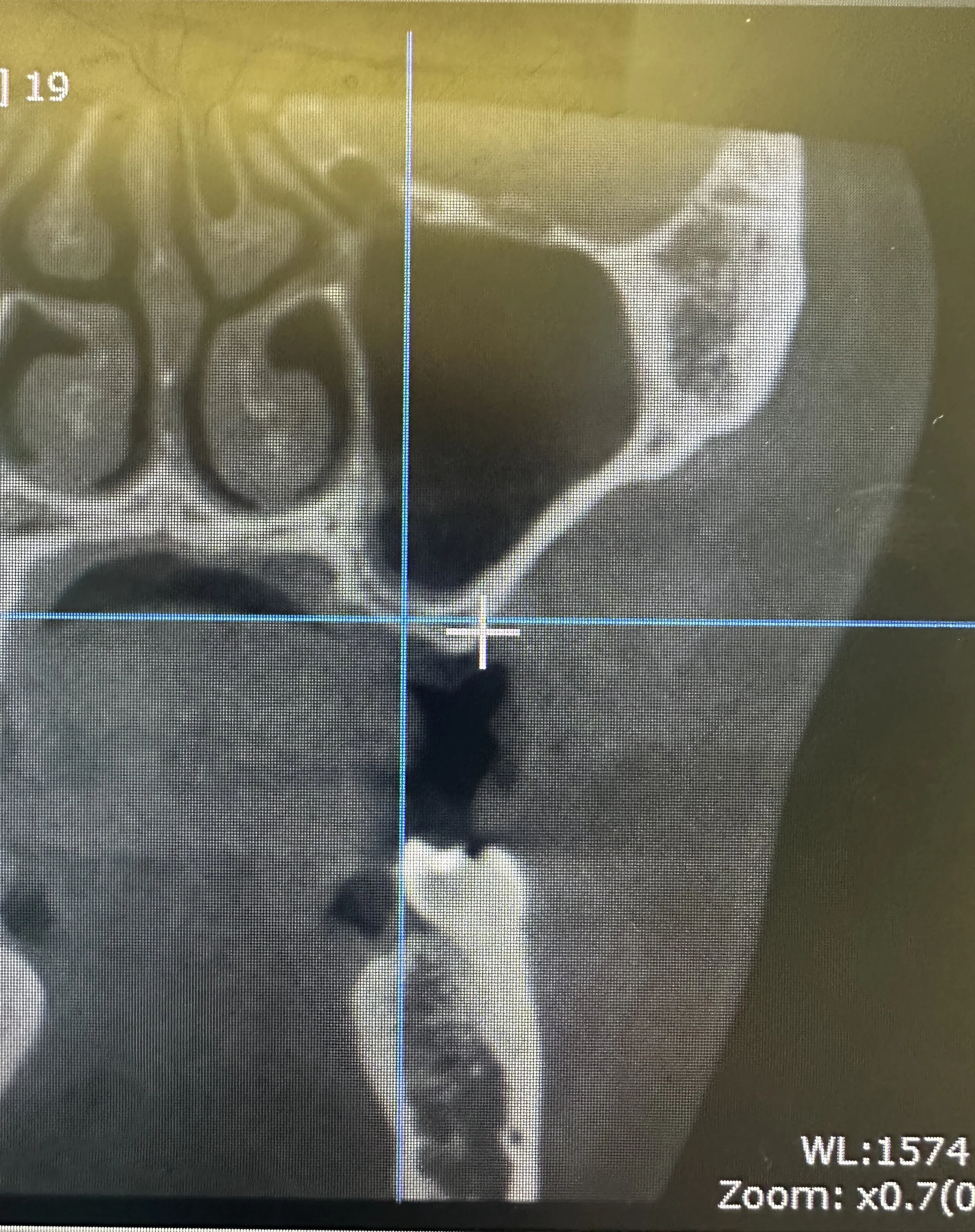 For professional reference only. All cases are anonymized and shared with patient confidentiality strictly maintained.