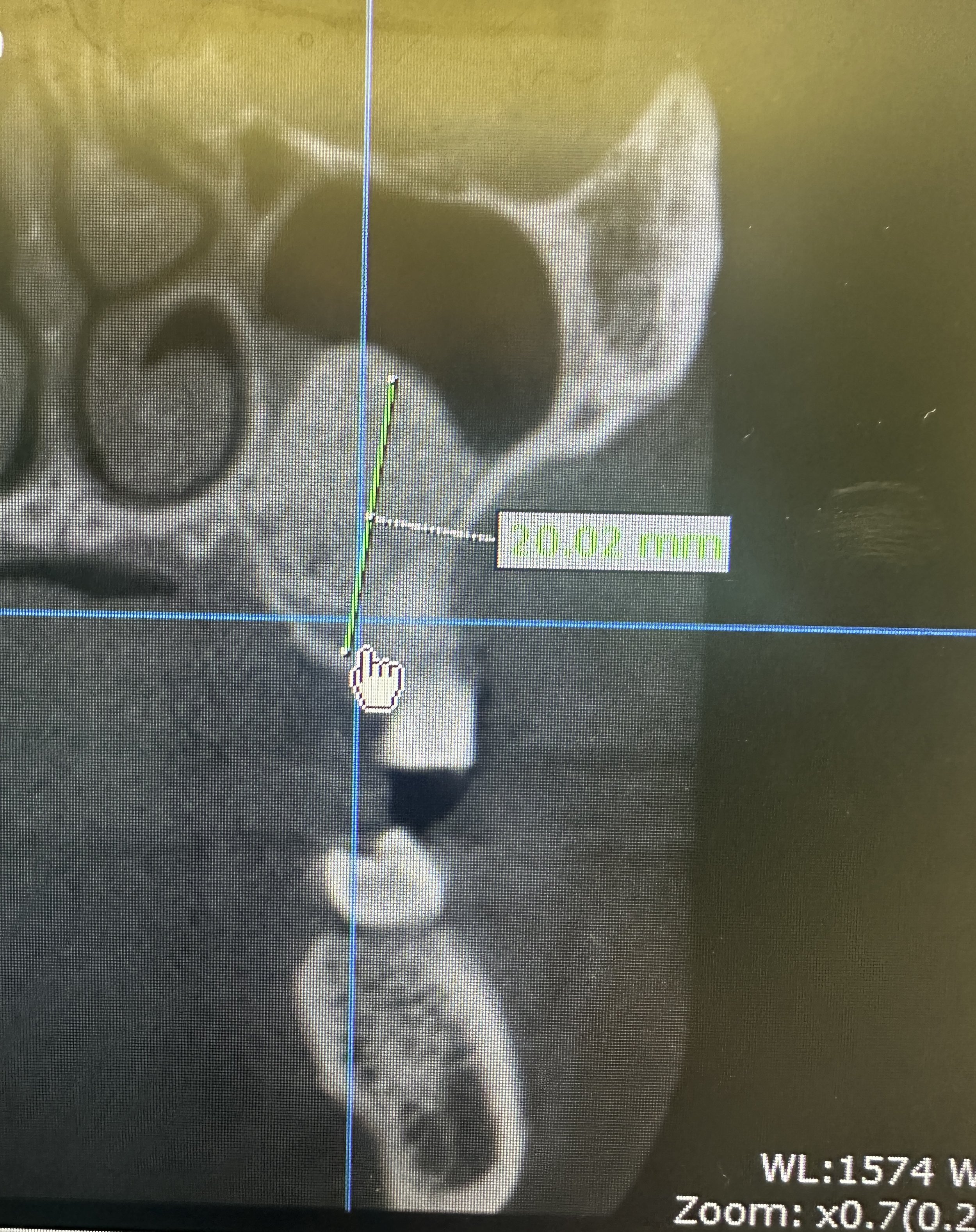 For professional reference only. All cases are anonymized and shared with patient confidentiality strictly maintained.