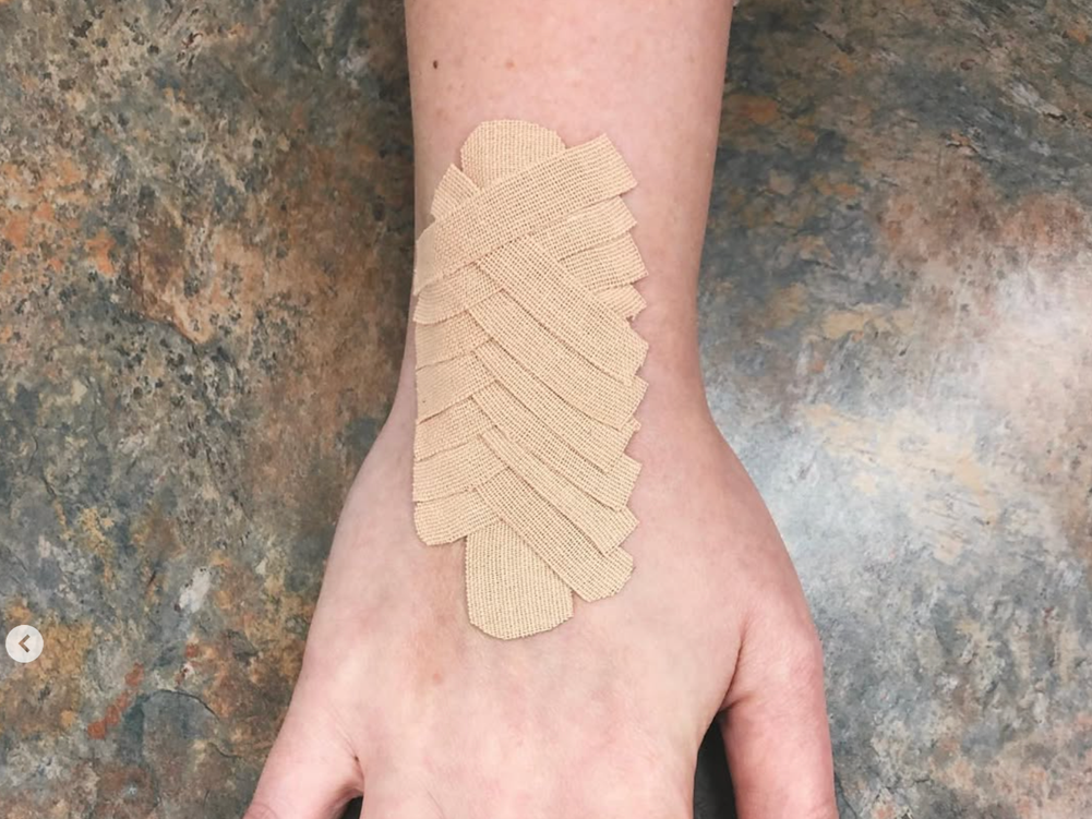 A person's hand with multiple beige adhesive bandages covering the wrist and part of the hand.