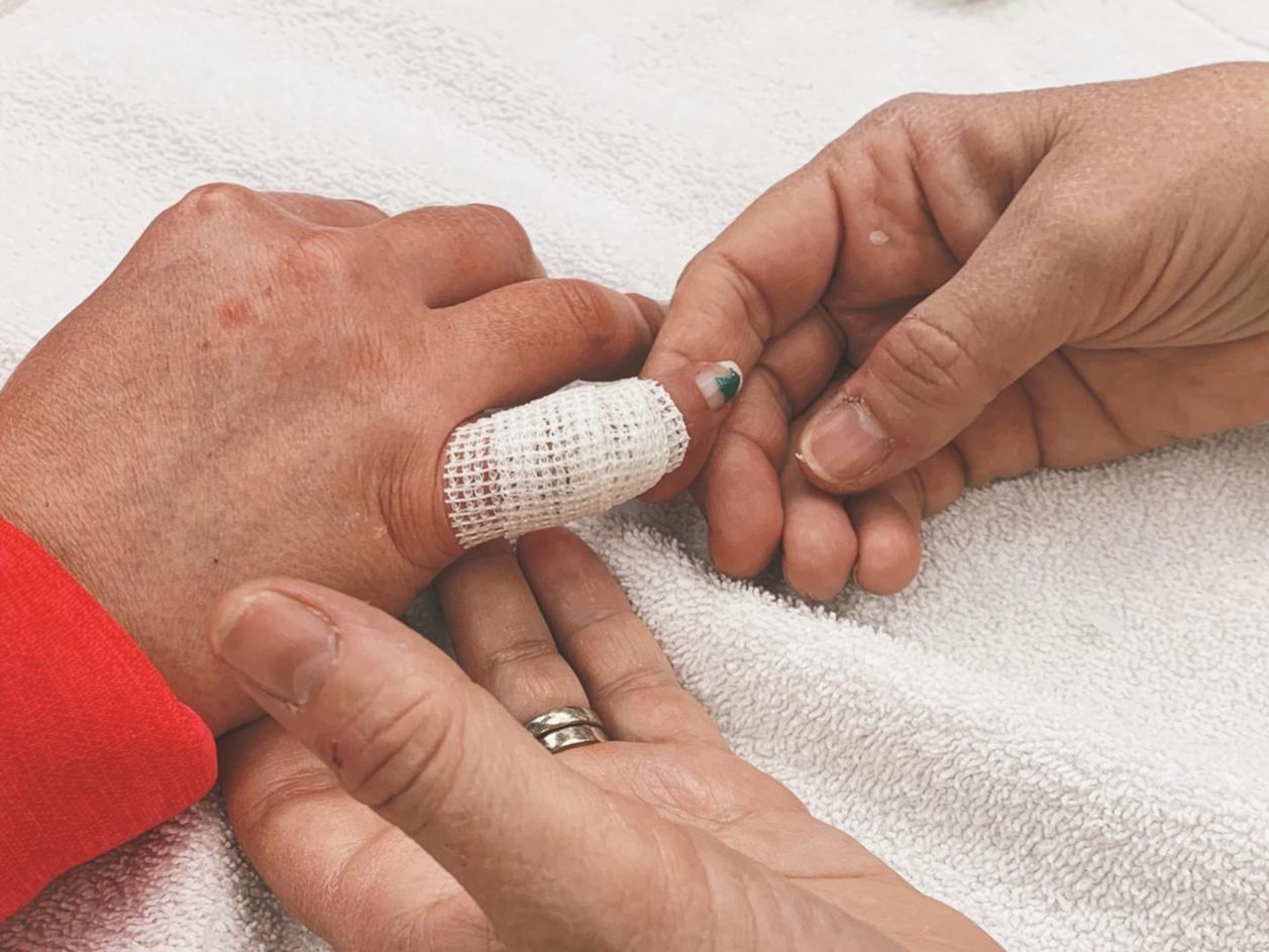 Two hands holding each other, one with a bandaged thumb, on a white towel.