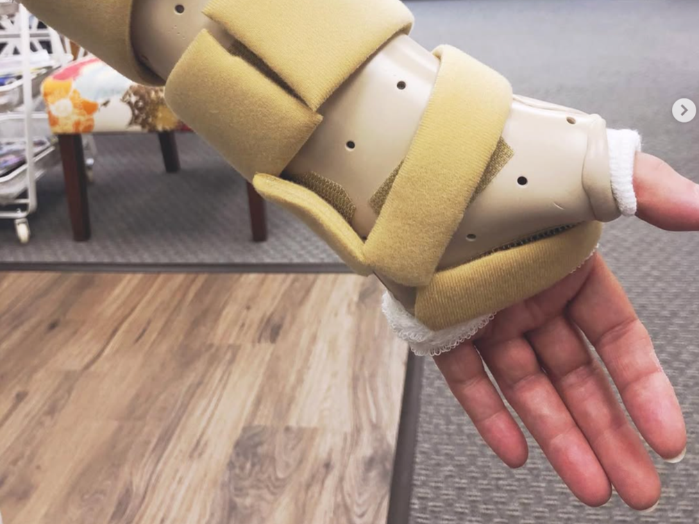 A prosthetic hand with a beige sock covering the wrist, displayed on a person's hand in an indoor setting with furniture and wooden flooring in the background.