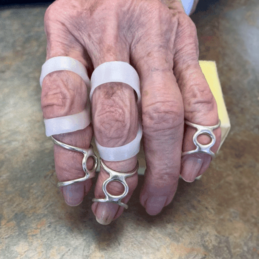Close-up of an elderly person's hand with fingerless gloves, rings, and white wristbands, resting on a surface.