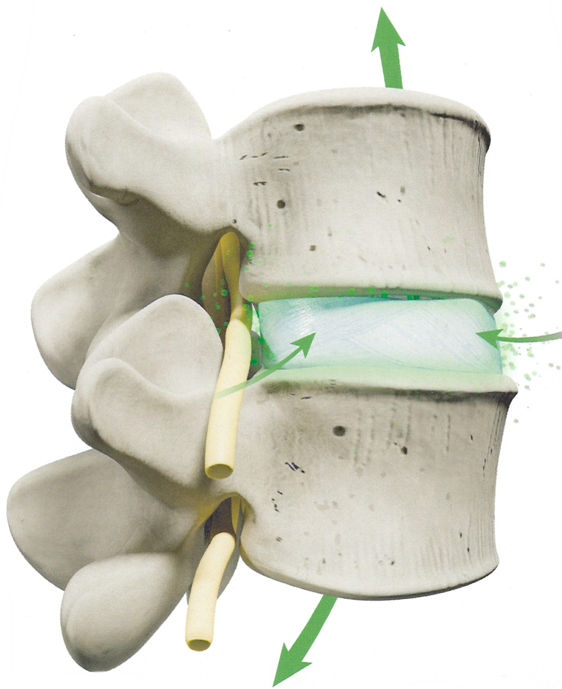 Spinal Decompression Nashville