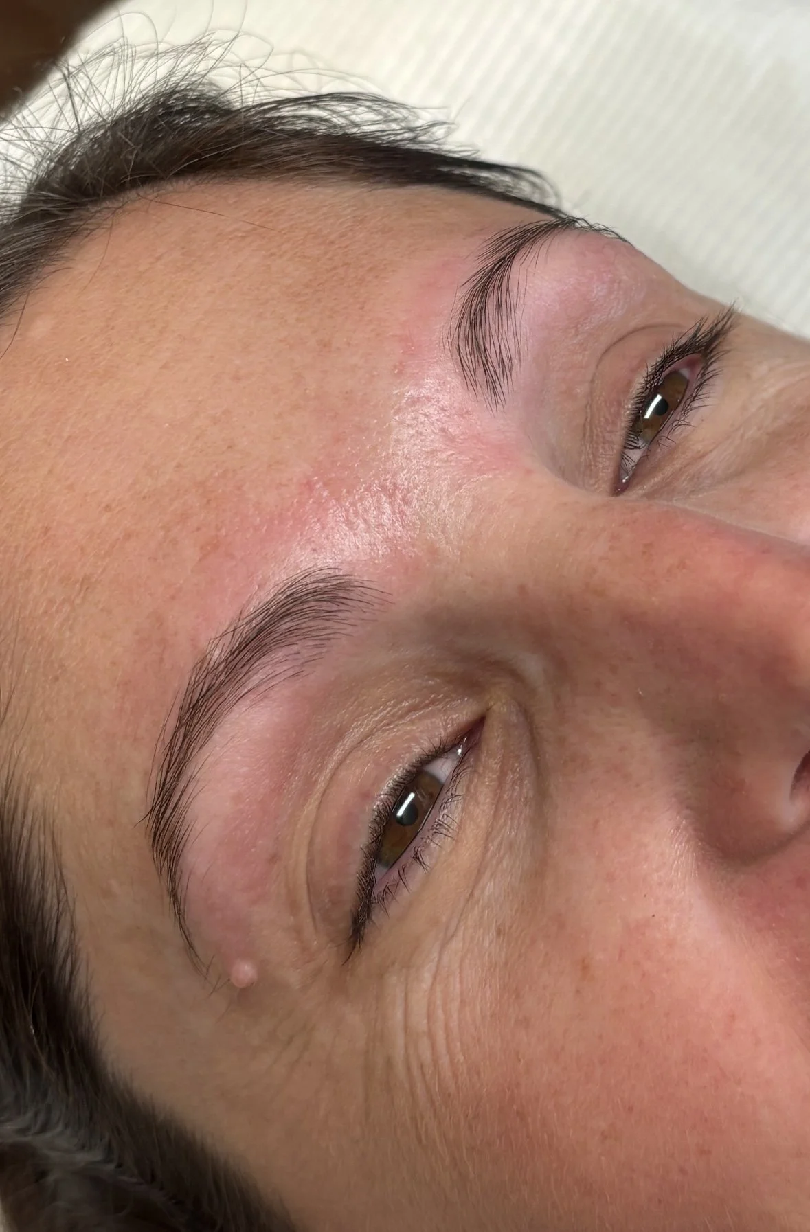 Close-up of a person's face showing their forehead, eyes, and part of their cheeks, with a focus on smooth skin and natural eyebrows.