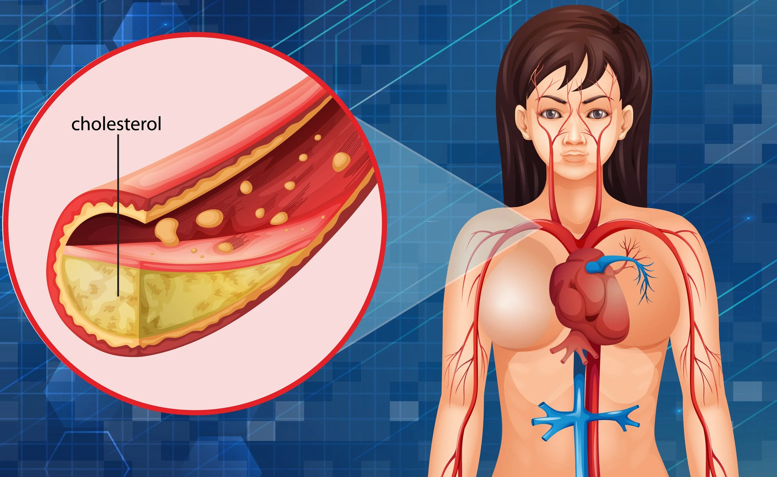 Advanced Cholesterol & Lipid Profile