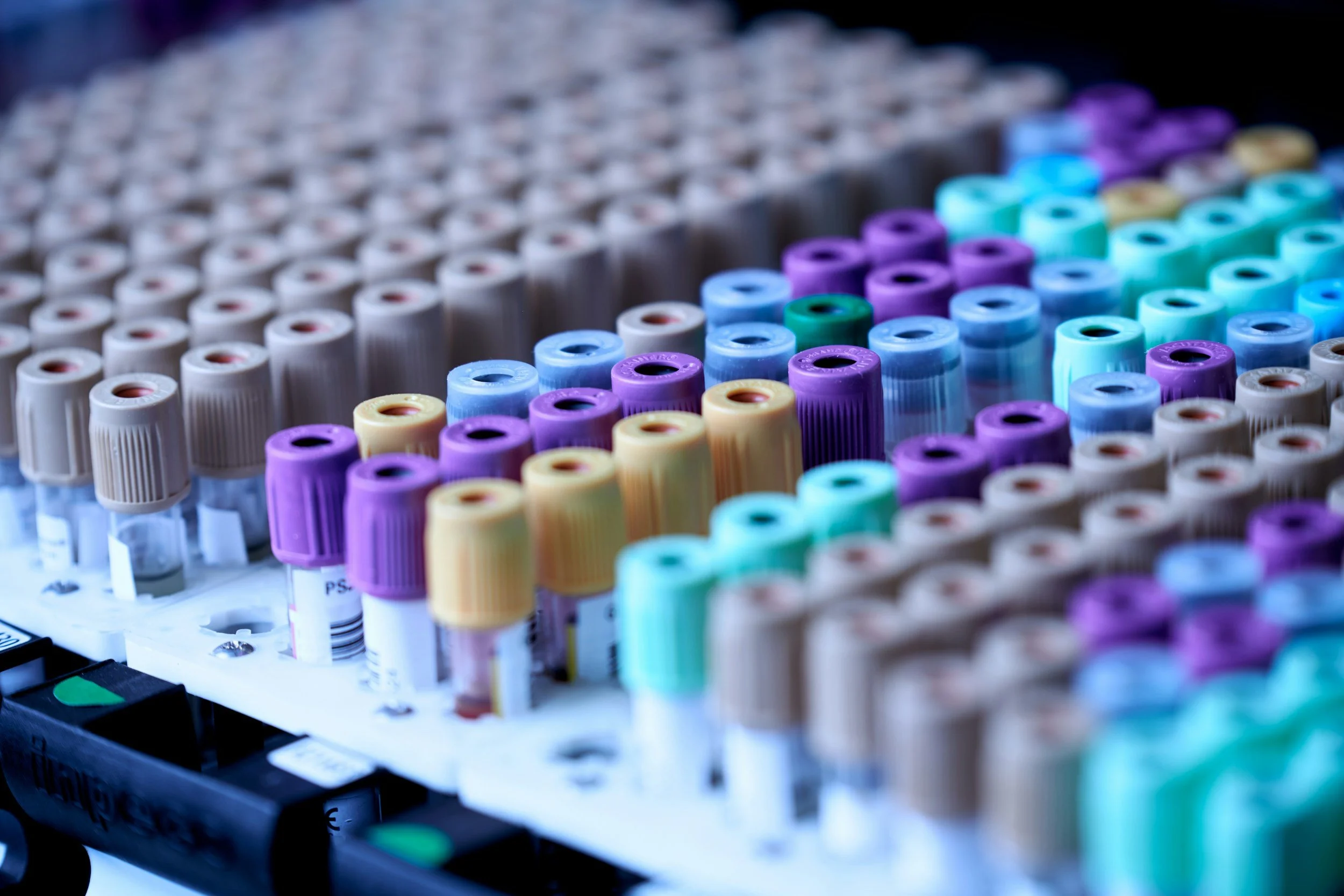Close-up view of numerous blood sample test tubes with color-coded caps organized in a tray.