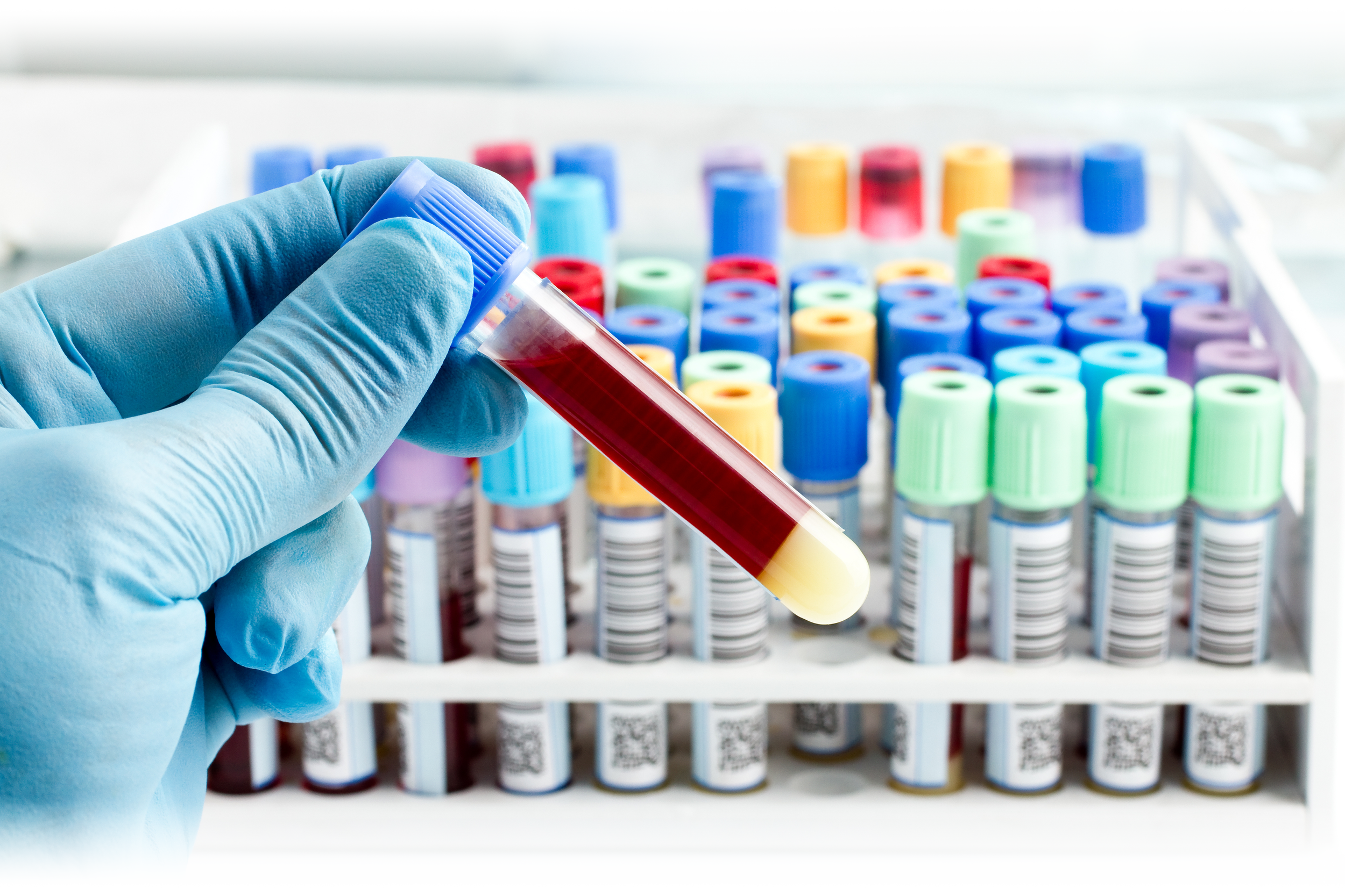 Close-up of a gloved hand holding a test tube filled with a red liquid, with a background of multiple similar test tubes in a rack.