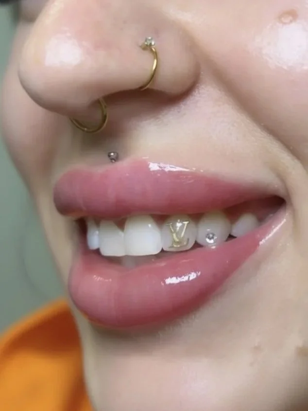 Close-up of a person's mouth showing lips, teeth with a gold letter 'V' grill, and multiple facial piercings including a nose ring and lip piercings.