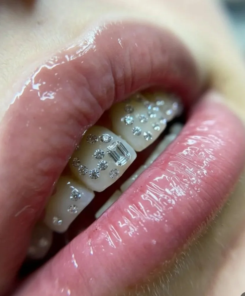 Close-up of a person's mouth showing teeth decorated with rhinestones and a large rectangular gemstone on the front tooth.
