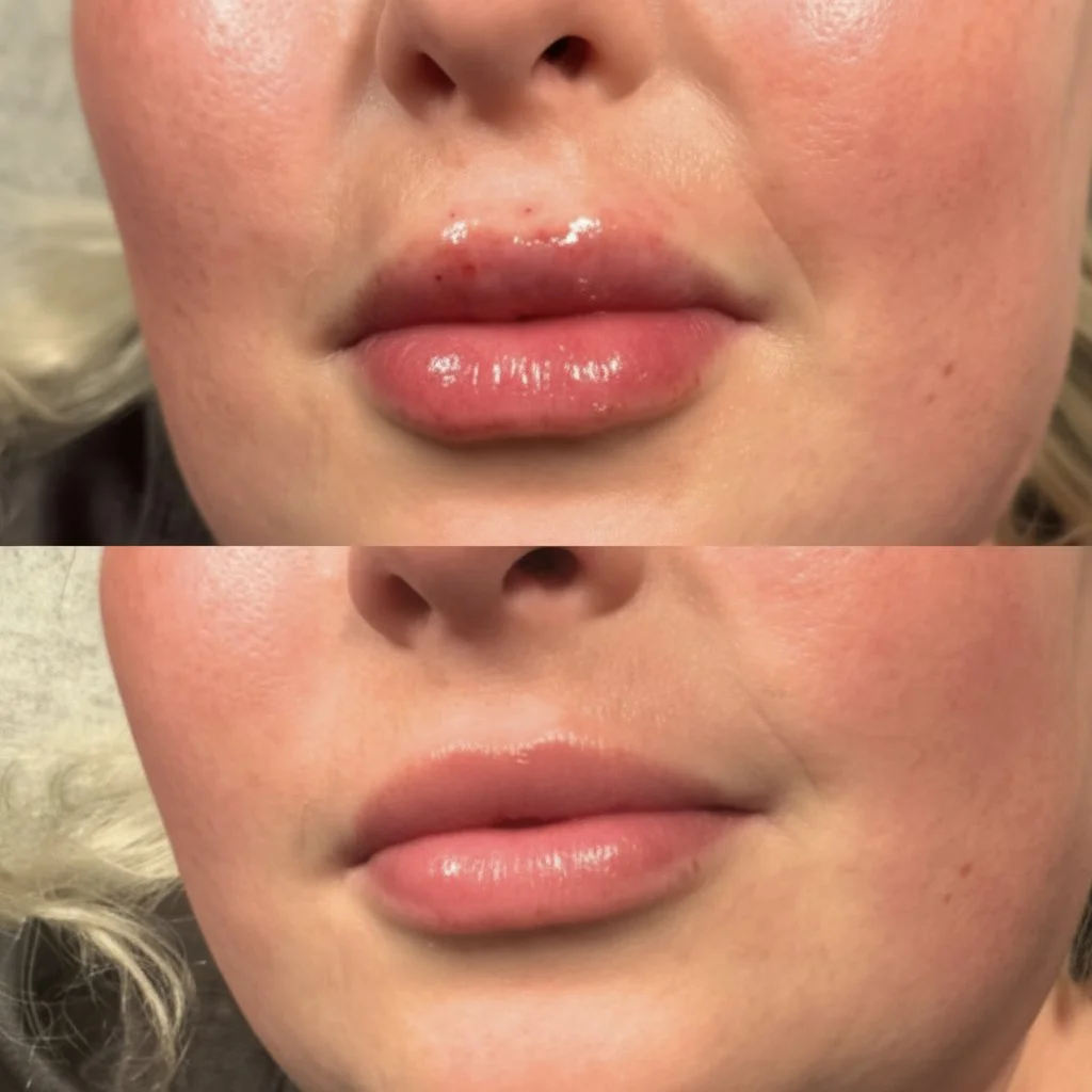 Close-up of a woman's lips, showing before and after lip gloss application, with slight redness and irritation on the lips in the top image, and smooth, glossy lips in the bottom image.