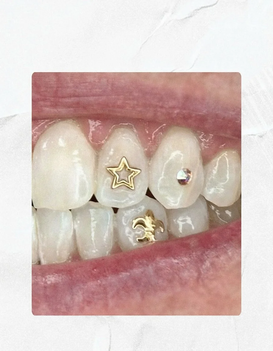 Close-up of a person's teeth with gold and rhinestone dental jewelry, including a star, a lion, and a number 3 design.