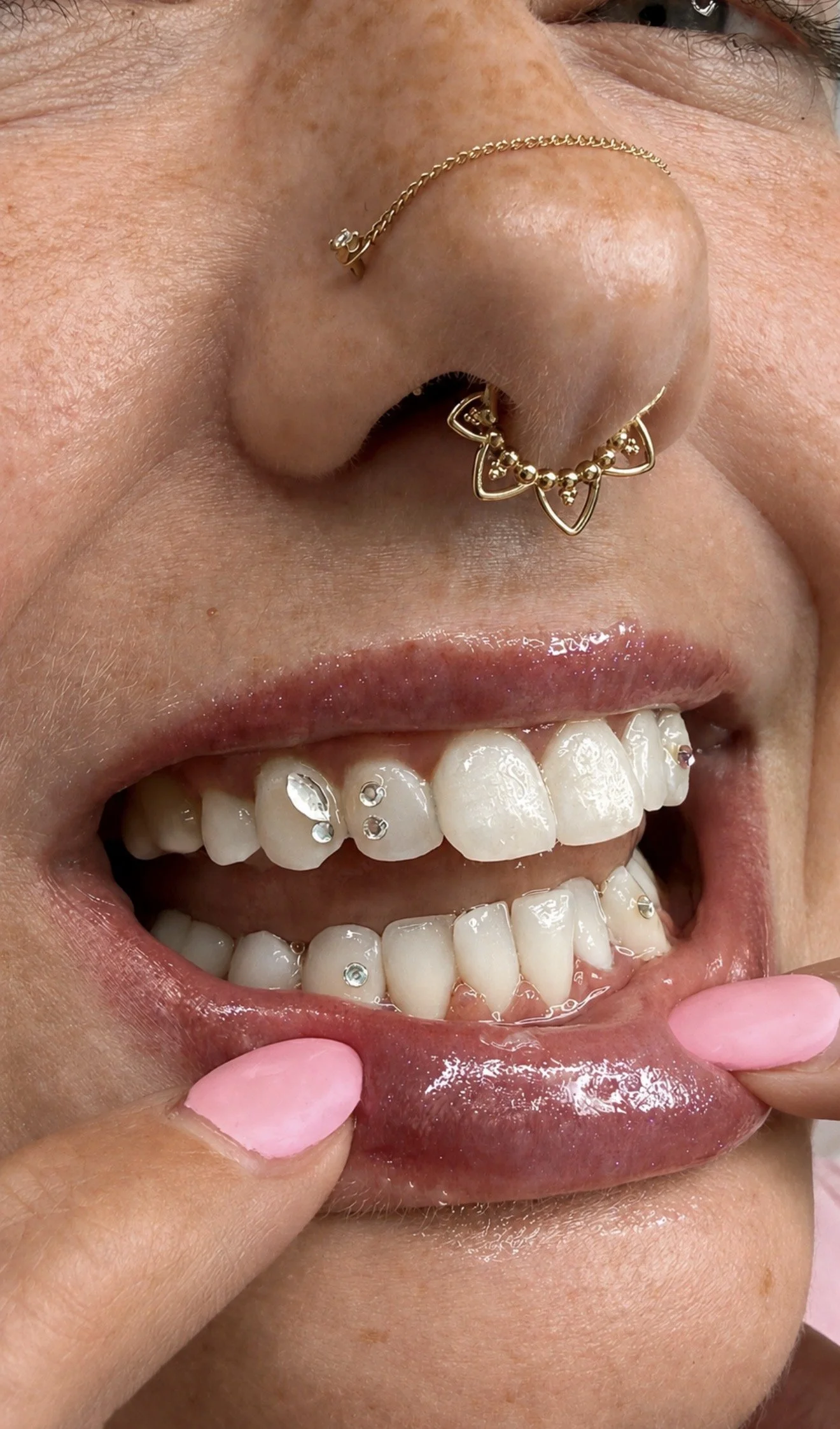 Close-up of a person's mouth and nose showcasing facial piercings, including a nose ring, a labret piercing, and multiple teeth with decorative jewelry, one of which has a gold Louis Vuitton logo.