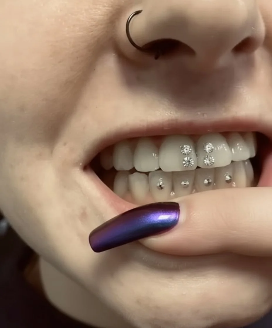 Close-up of a person's mouth with metal piercings on the lower teeth, a nose ring, glossy dark purple nail polish, and a finger touching the lip.