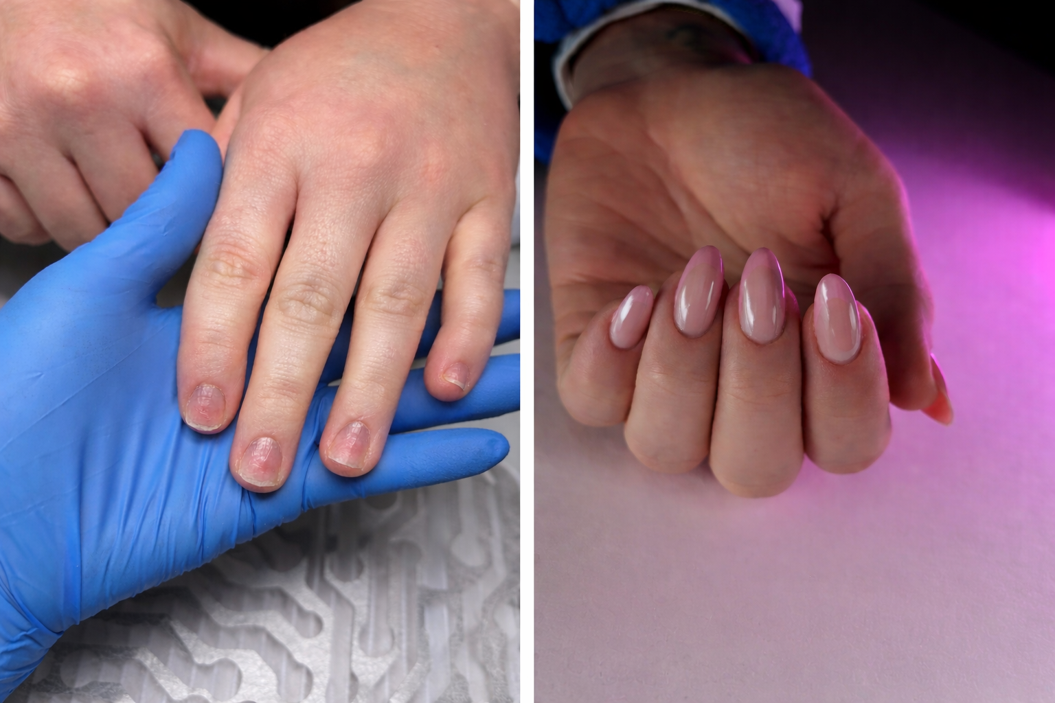 Structural Nail Restoration