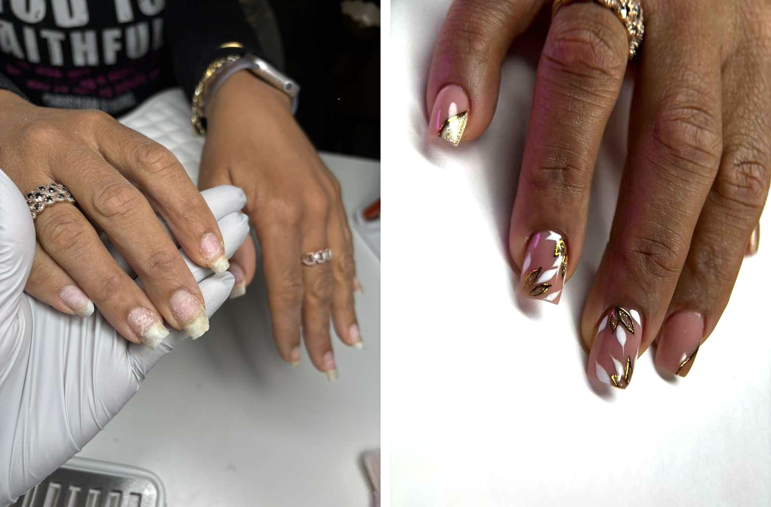 Burned and Over-Filed Nails