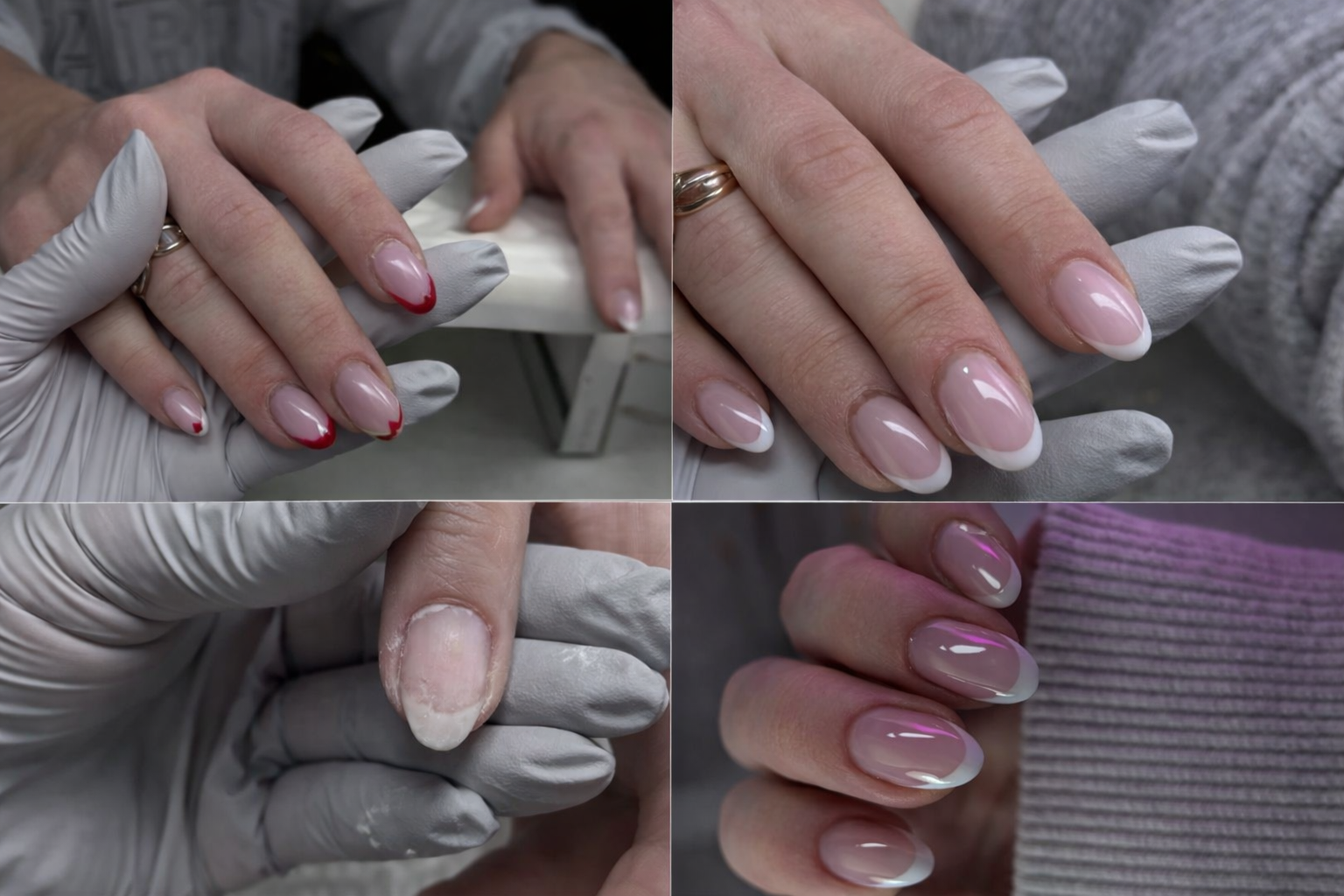 Restoring the Foundation — A Nail Restoration Journey