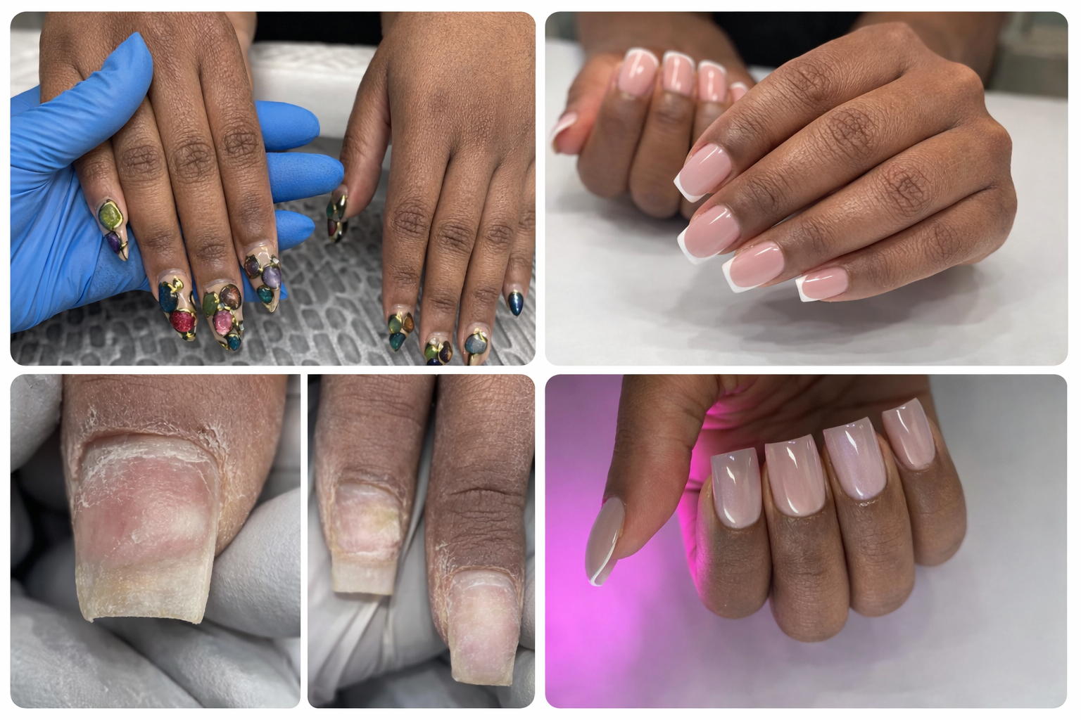 Delayed Hard Gel Maintenance — A Nail Restoration Journey