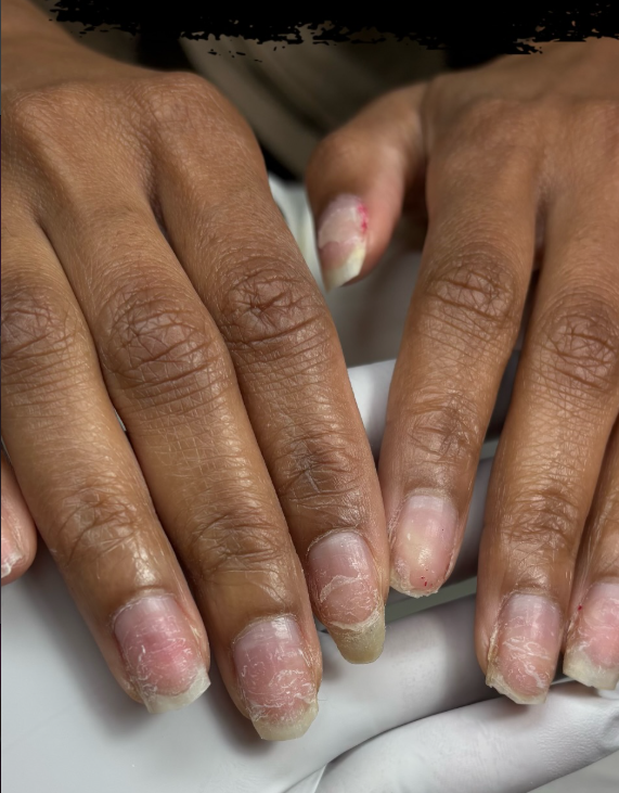 Why You Should Never Remove Your Coating Yourself