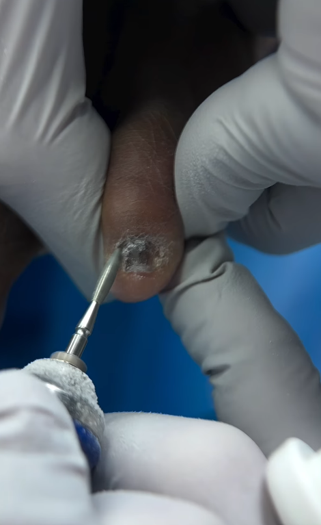 How long your feet stay smooth is entirely up to you.