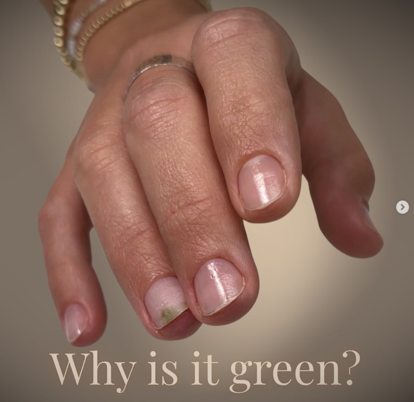 Why is it green?