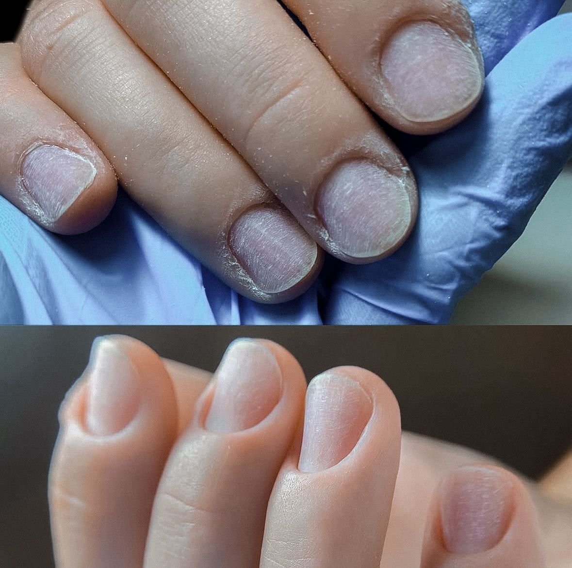Russian hygienic manicure using precise e-file cuticle work to improve natural nail health and skin condition