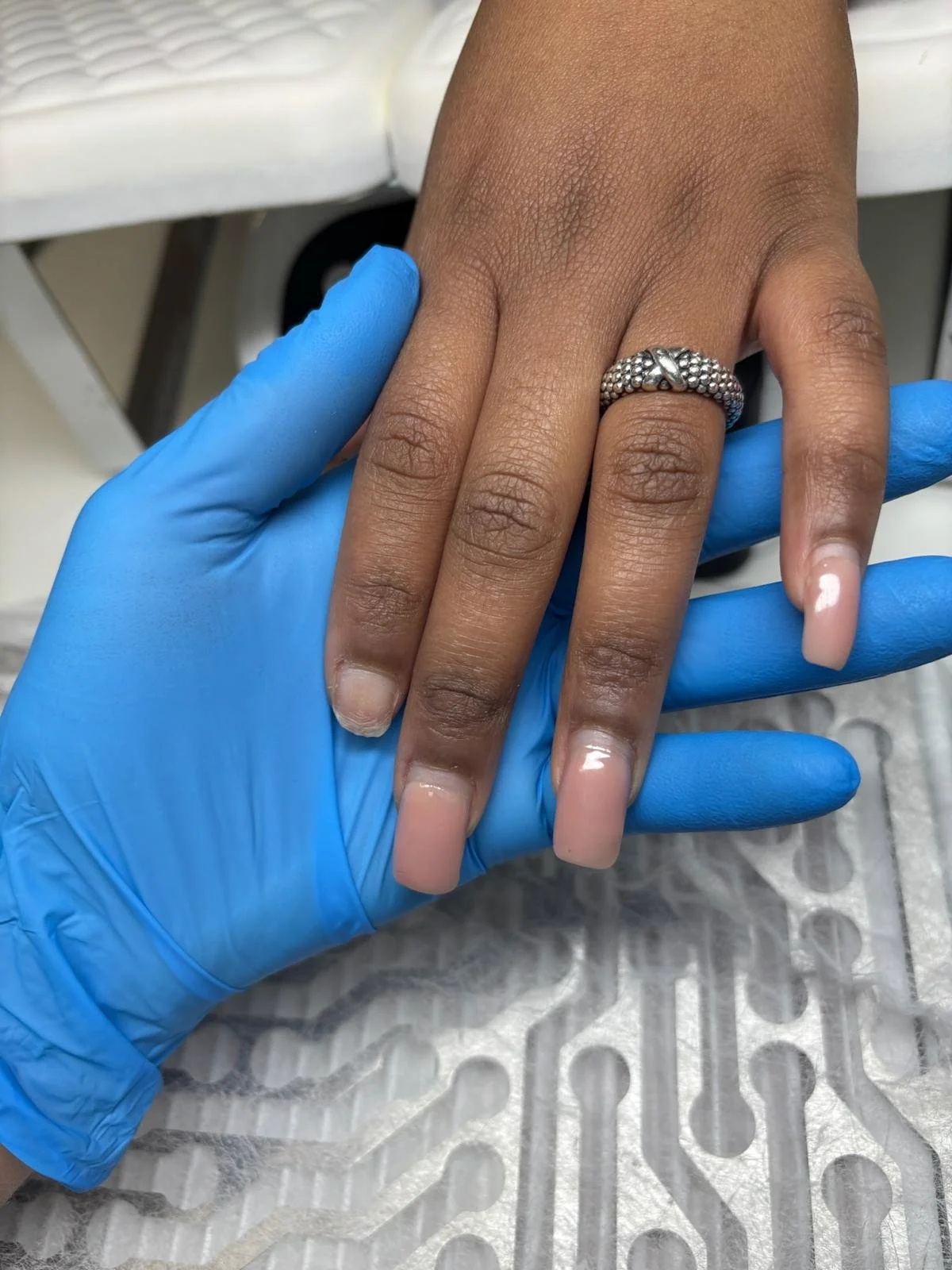 Session 3 arrival – first delayed maintenance after nearly six weeks, showing overgrown nail structure.