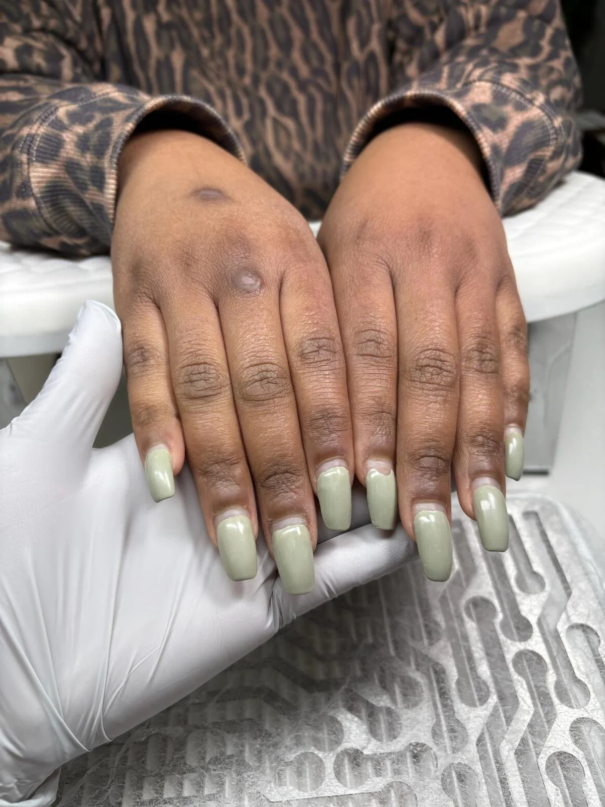 Session 4 arrival – second delayed maintenance after approximately 5.5 weeks, showing unstable nail architecture.