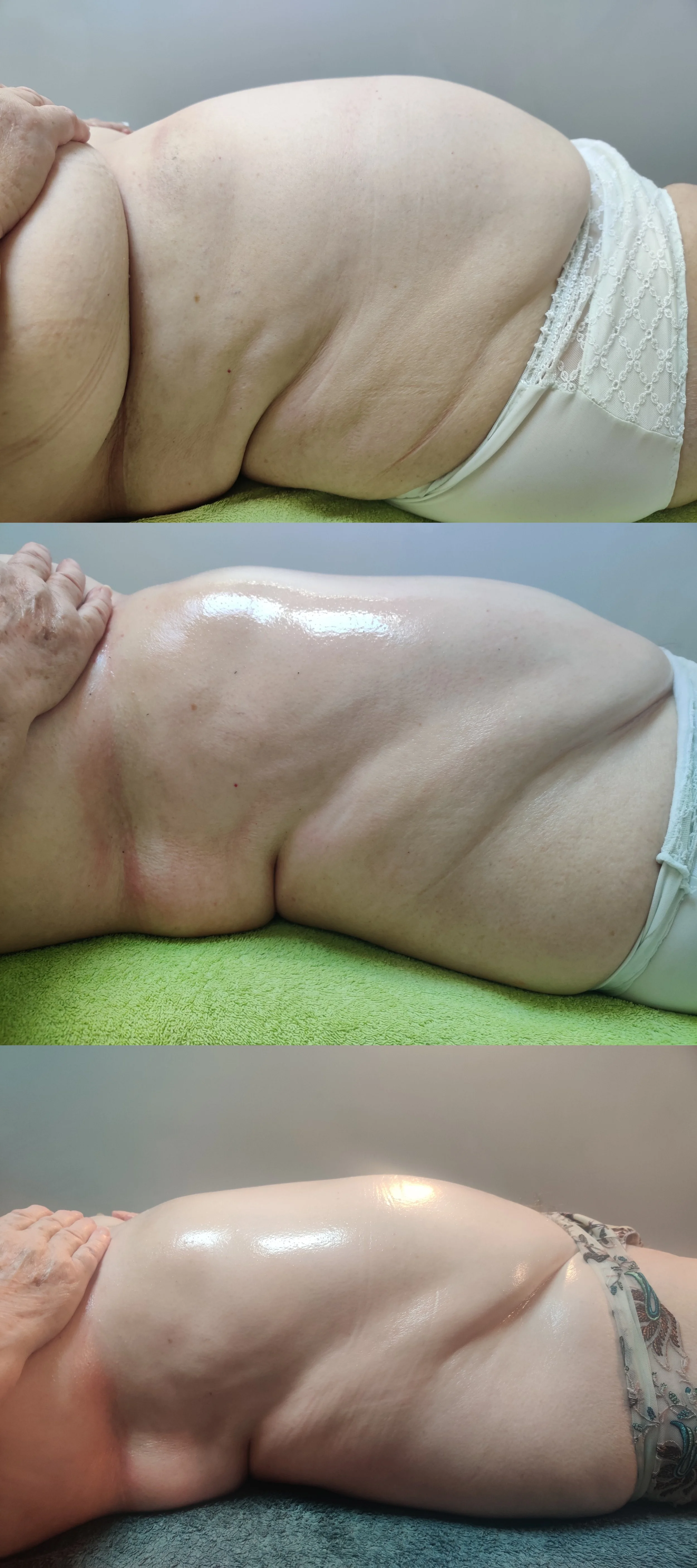 Trois images d'une femme allongée sur le dos. La première montre le ventre avant un traitement, la deuxième montre la peau pendant le massage avec une peau plus lumineuse et lisse, et la troisième montre un ventre dégonflé et sculpté.