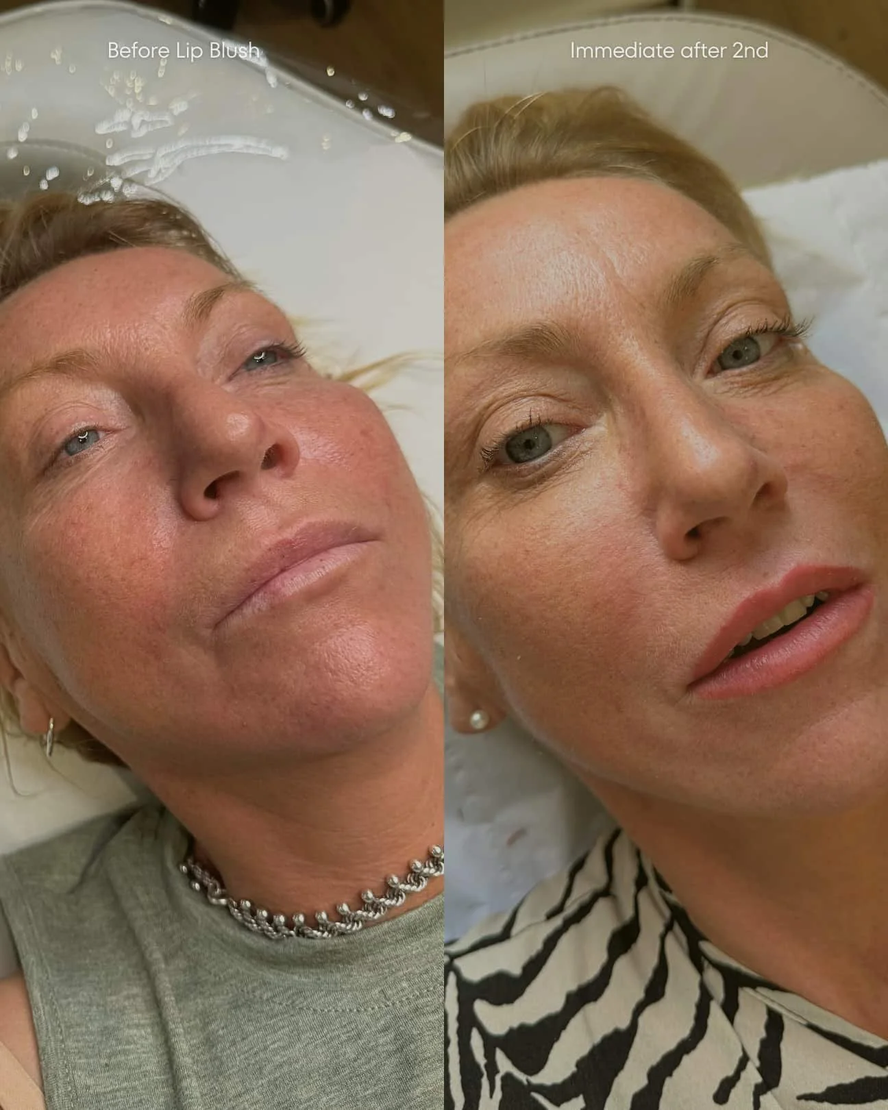 Perfecting the lip blush on a lady, with lips looking absolutely fabulous after the second session.