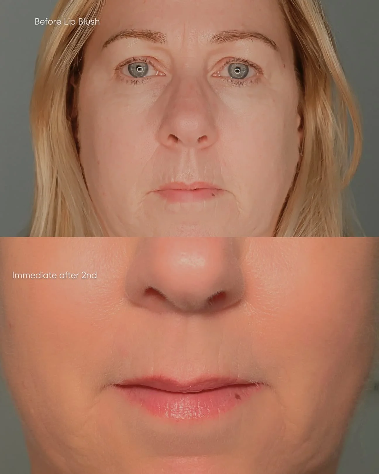 Lovely pink shade of lip blush on more mature lips and pale skin, available at Elite PMU in Marylebone