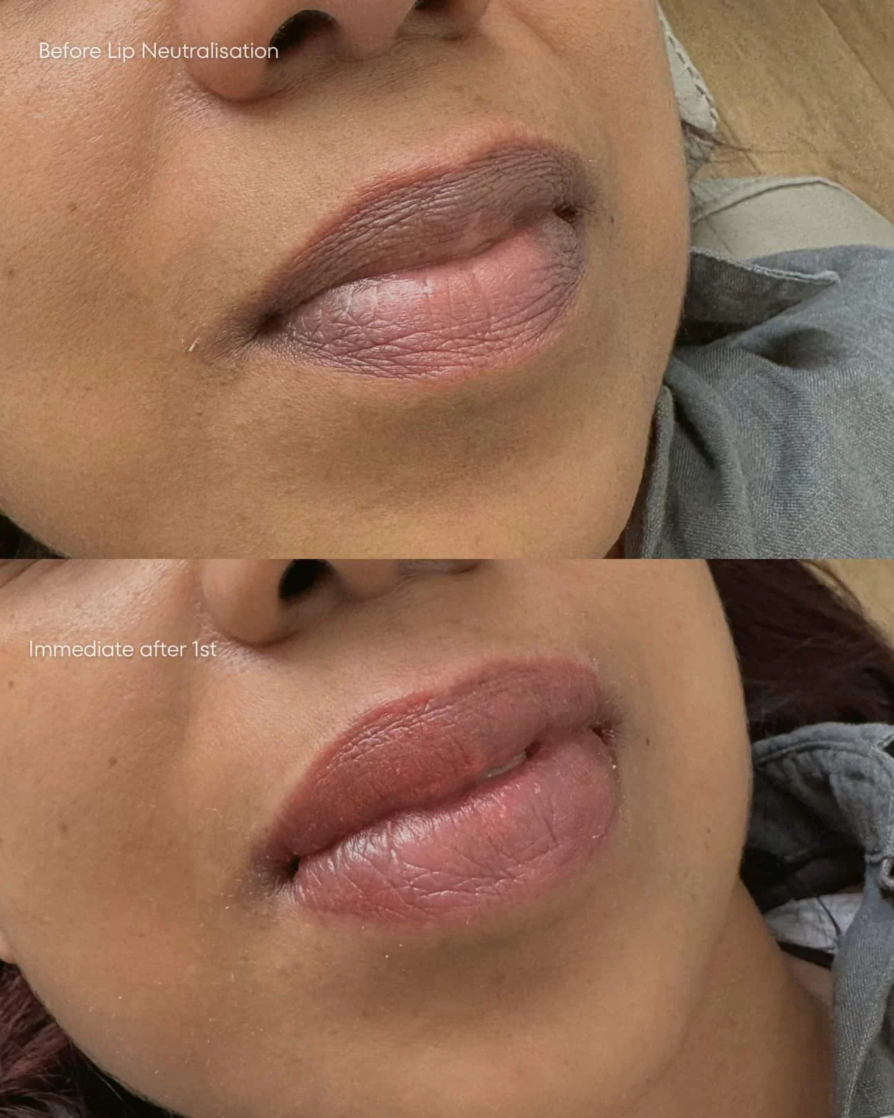 Dark lip neutralisation result on indian client at Elite PMU London.
