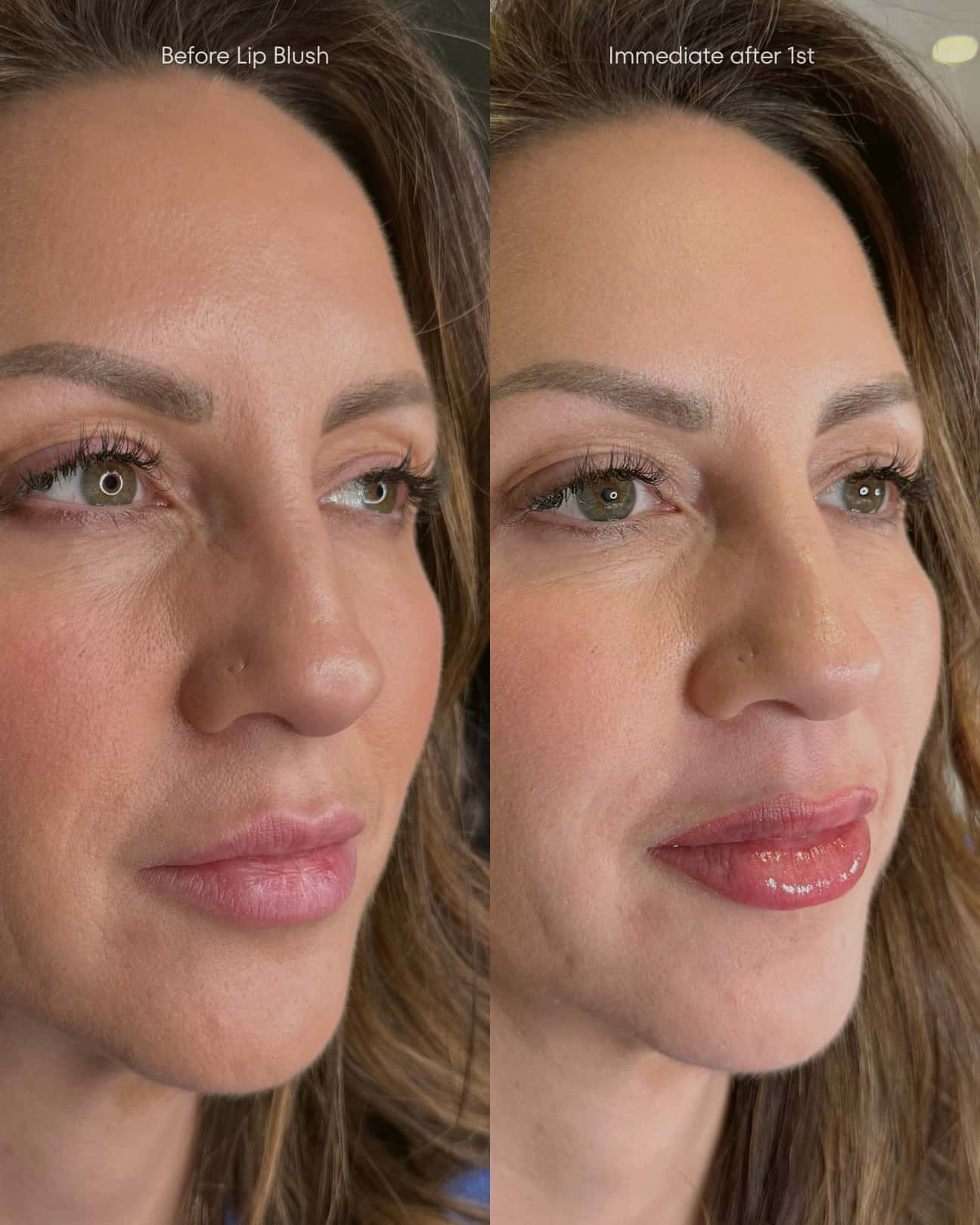 Darker sheer application of lip blush at Elite PMU Chelsea