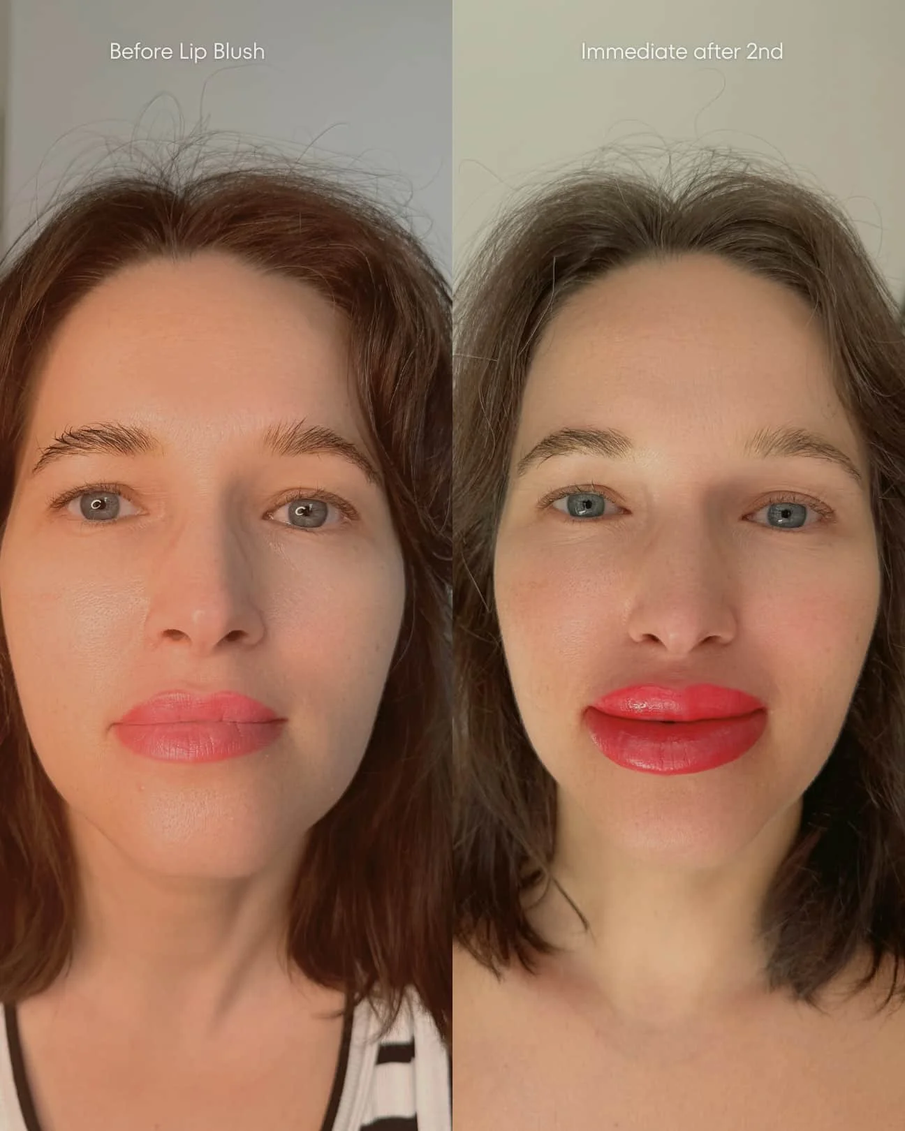 Strong powerful HD lipstick effect lip blush on young lady. Lips are swollen after the second procedure.