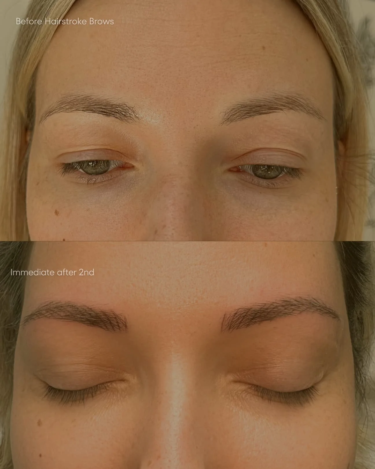 Comparison of eyebrows before and immediately after a nano hairstroke brows on pale skin client.