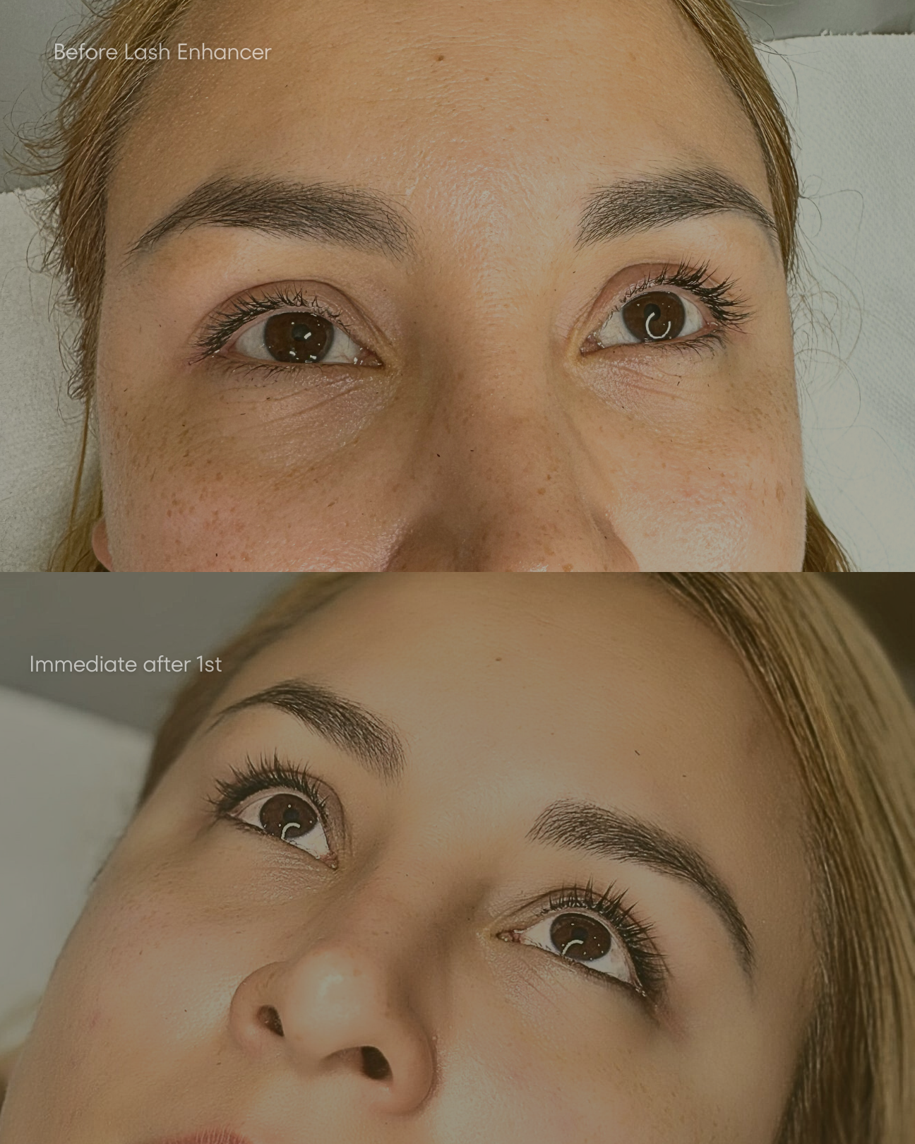 Lash Enhancer Eyeliner Treatment Before/After