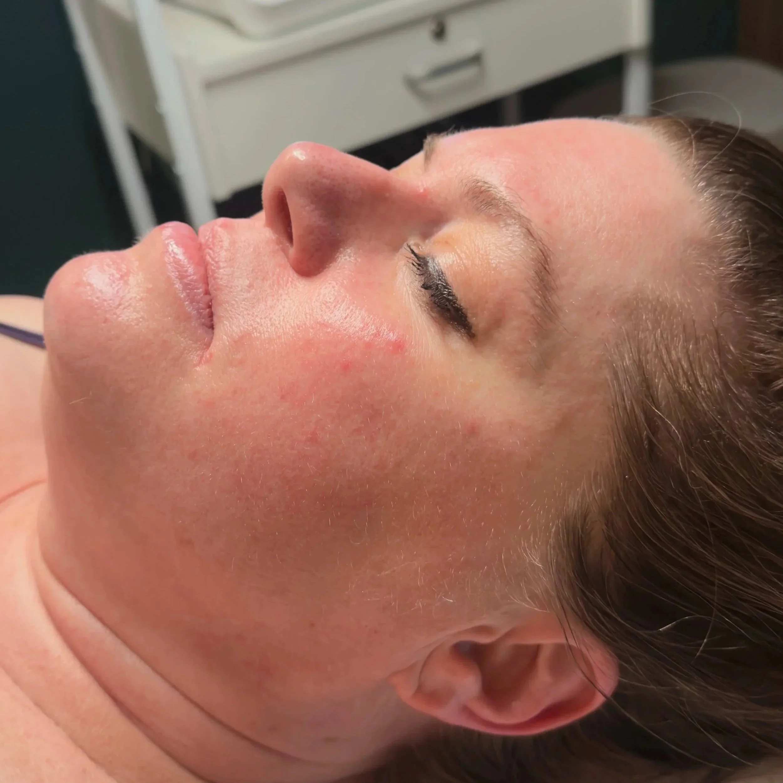 Glass Skin Facial results showing hydrated glowing skin.