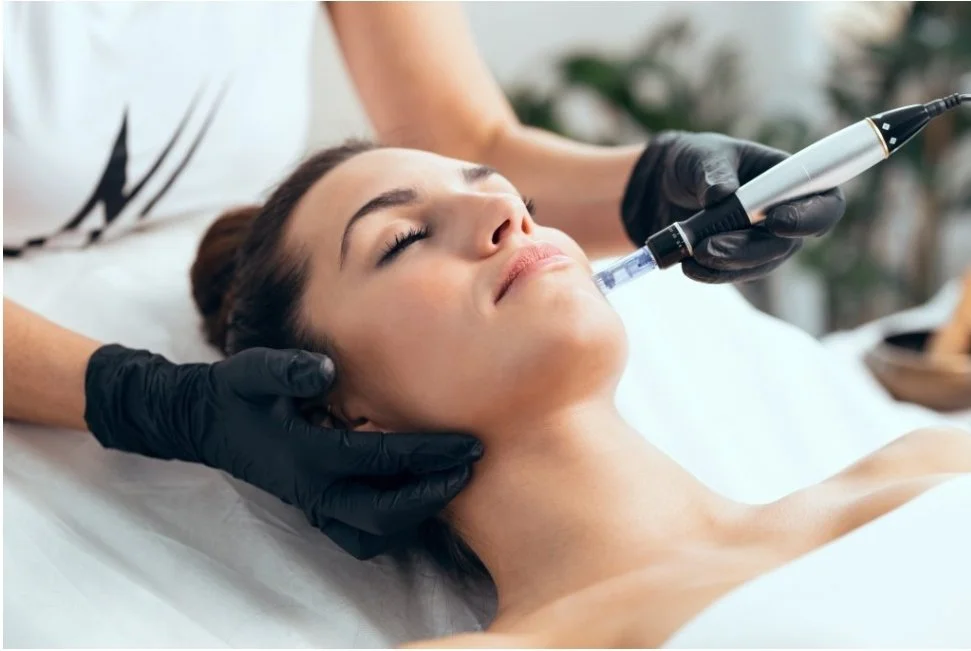 A woman receiving a facial treatment using a microneedling pen, lying on a treatment bed with her eyes closed while a professional in black gloves performs the procedure.