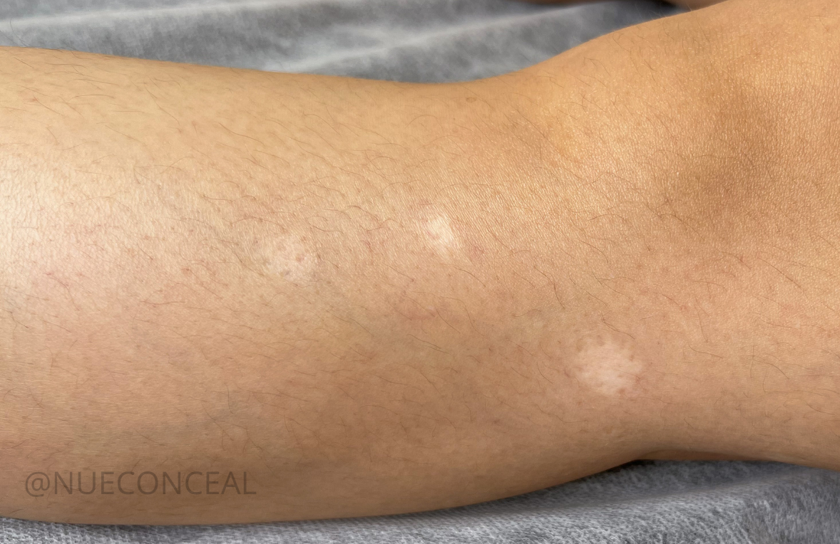Legs scar camouflage.png