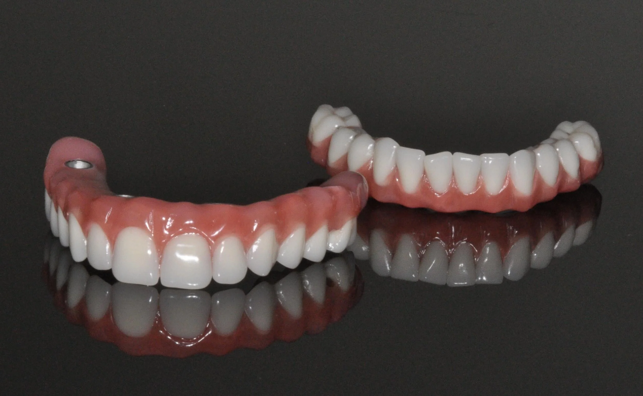 All-on-4 and full-arch dental implants in Toronto and North York by Dr. Onur Cavus — advanced fixed full-mouth rehabilitation with precise digital planning and IV sedation.