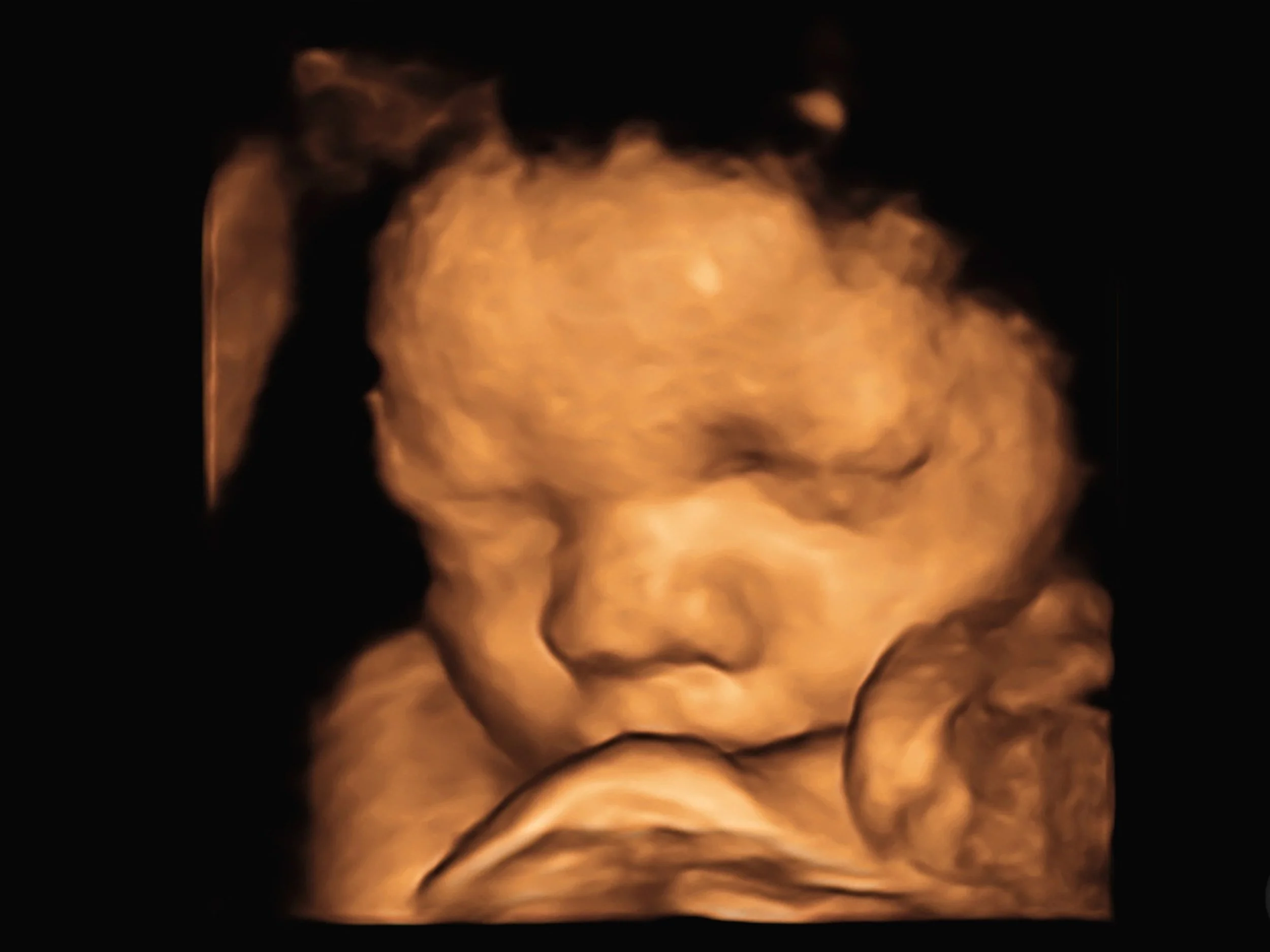A 3D ultrasound image of a sleeping baby with closed eyes, resting head on hand.