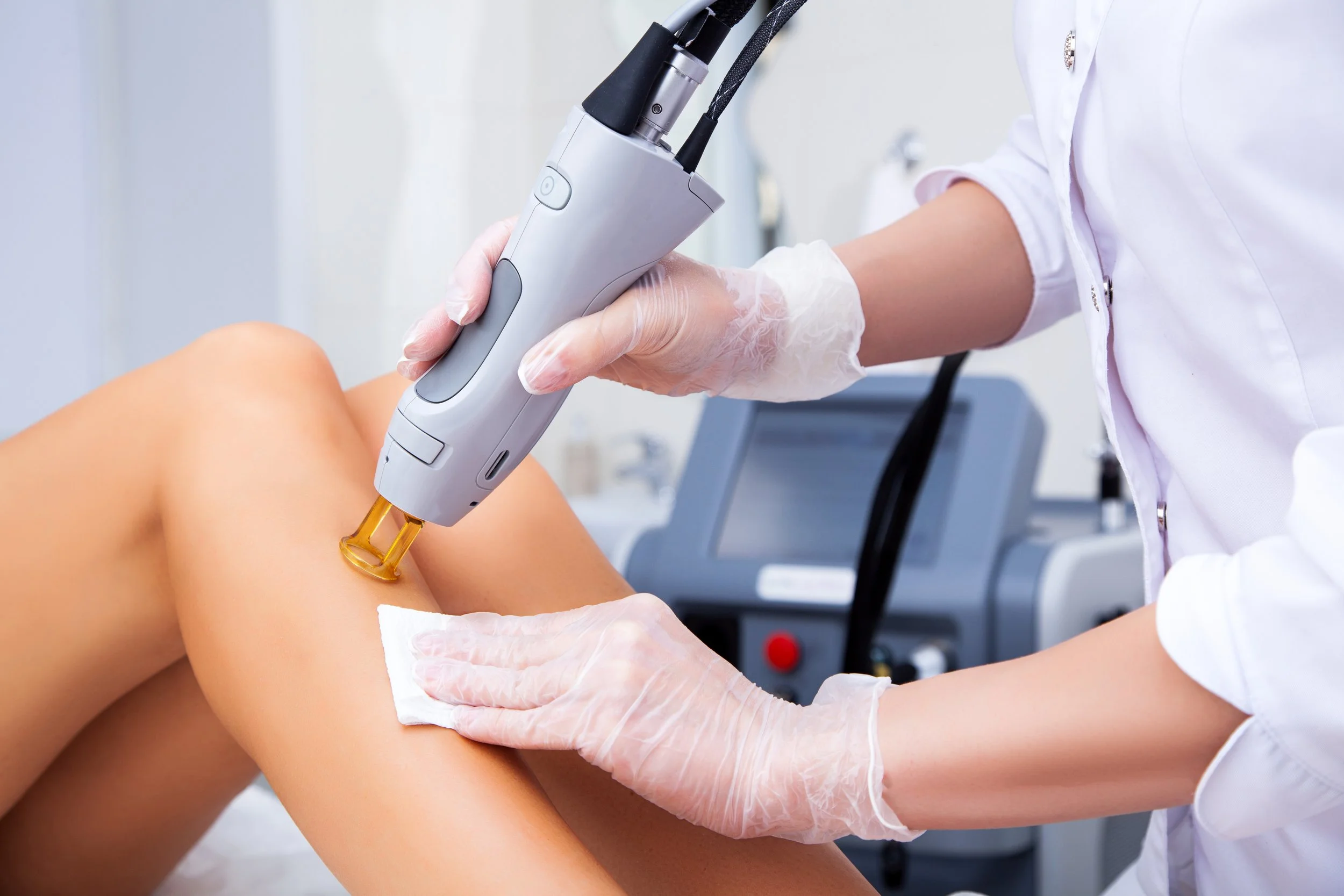 A medical professional performs a laser treatment on a patient's leg, wearing gloves and using a handheld device in a clinical setting.