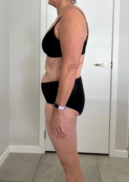 Side view before image - body transformation. Womans weight loss journey