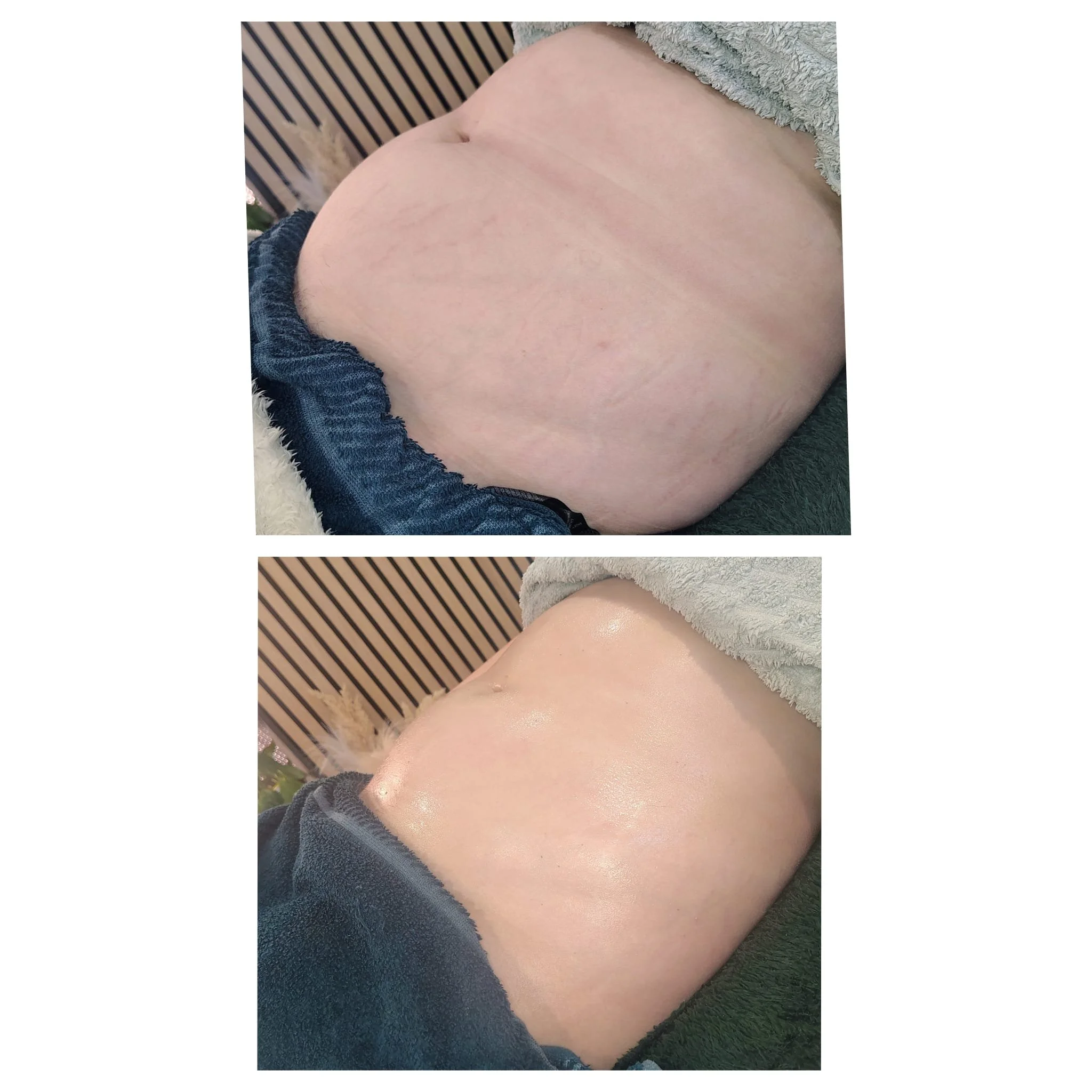 Close-up of a person's abdomen with the lower part of a towel and a pair of blue jeans visible, lying on a striped wooden surface.