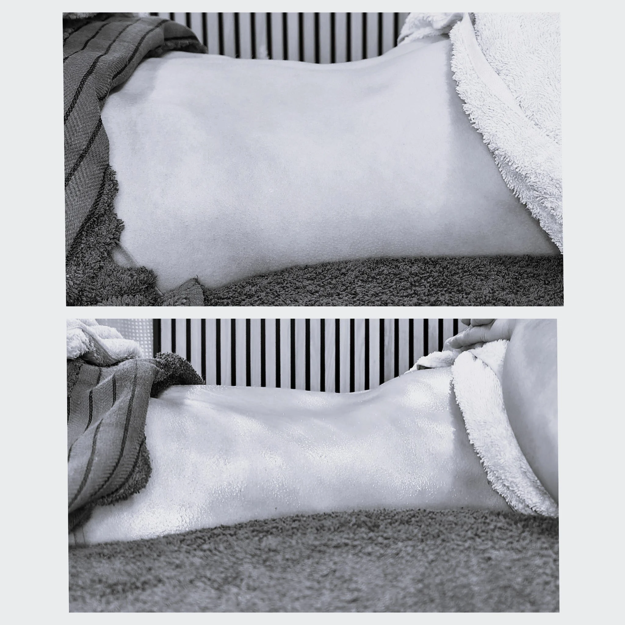 Lymphatic Drainage and Wood Therapy- three areas 120 minutes