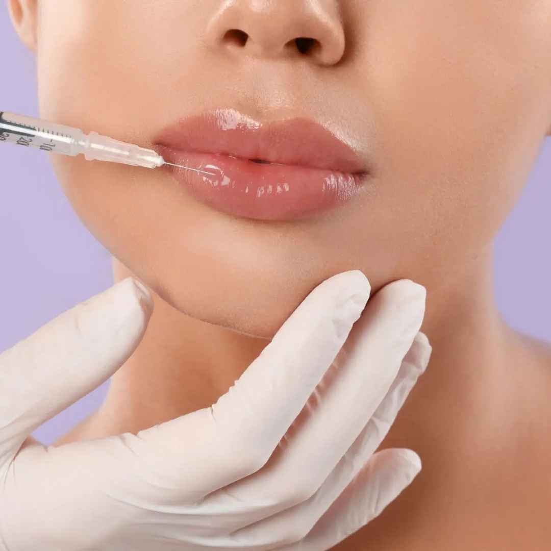 Z Technique Lip Filler at Zibella Med Spa