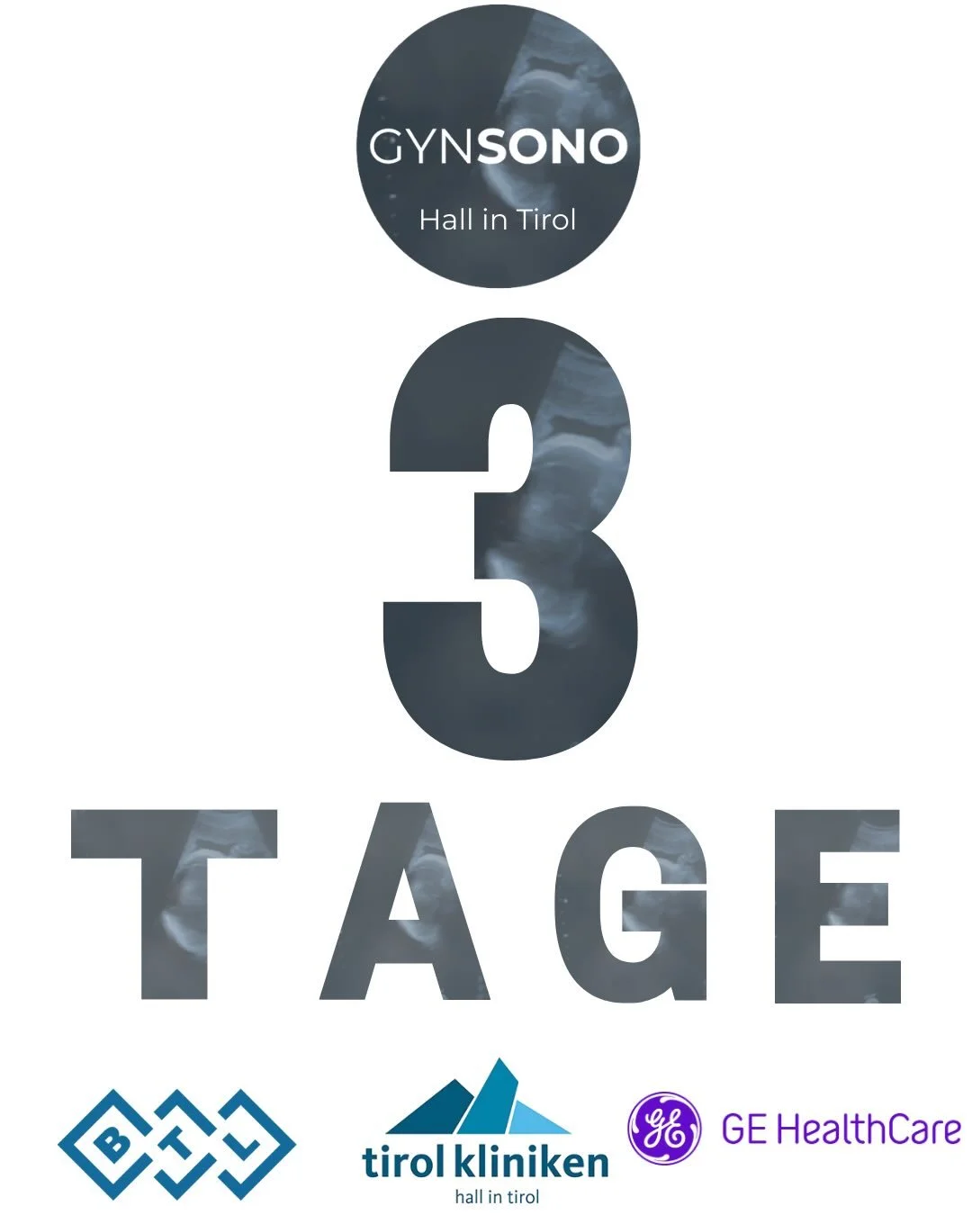 Wir freuen uns sehr, Sie in drei Tagen in Hall in Tirol begr&uuml;&szlig;en zu d&uuml;rfen und gemeinsam ein sehr lehrreiches Wochenende rund um die gyn&auml;kologische Sonographie zu verbringen.

📍 Anreise: Milser Stra&szlig;e 10, Hall in Tirol 

W