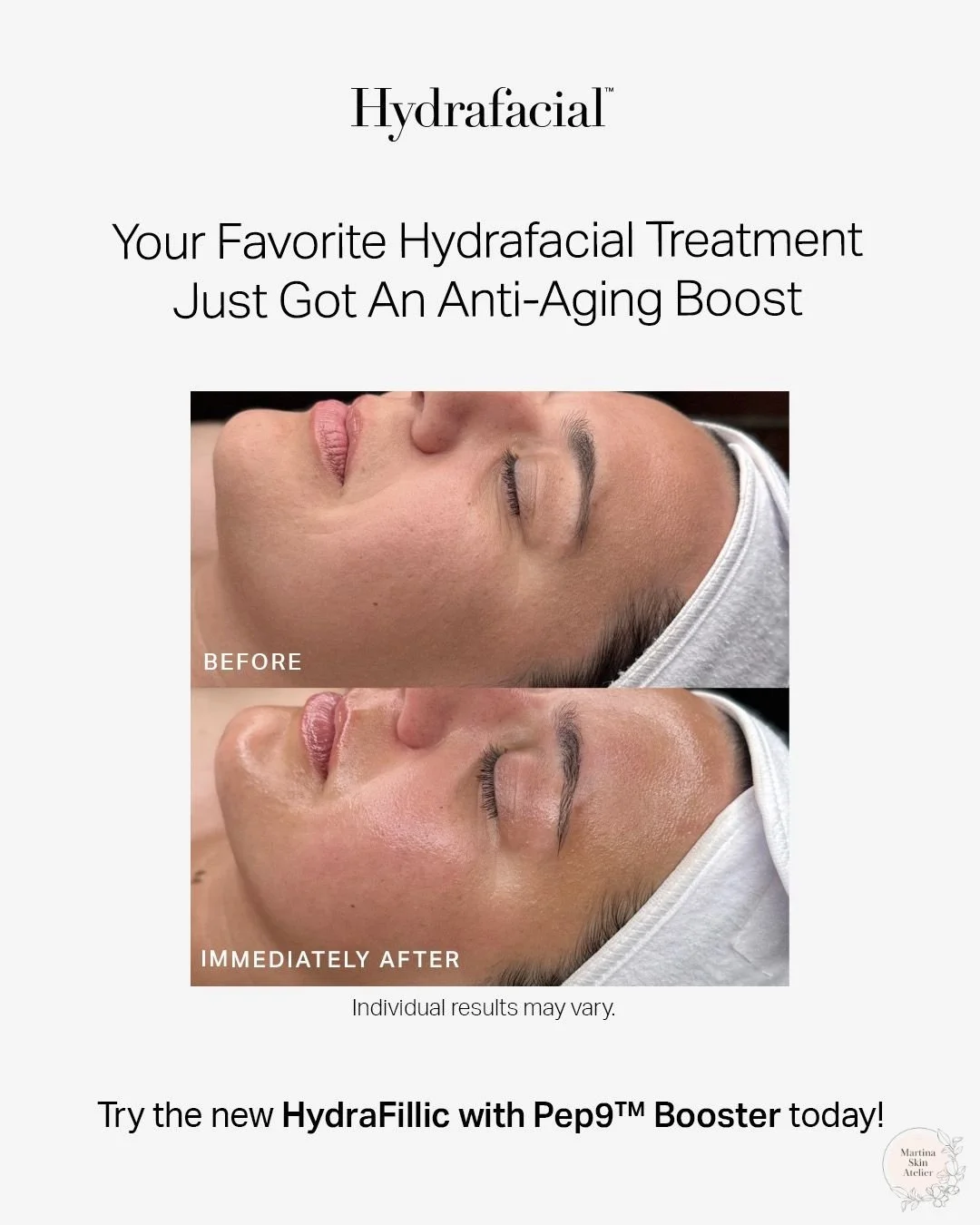 ✨ Real results, right away
The new HydraFillic with Pep9&trade; Booster is your anti-aging upgrade to the Platinum HydraFacial

💧 Instantly plumps and hydrates
🔬 Visibly smooths fine lines
⚡ Delivers firmer, more radiant skin after just one treatme
