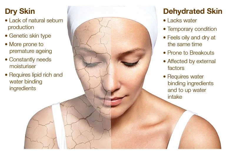 dry vs dehydrated skin